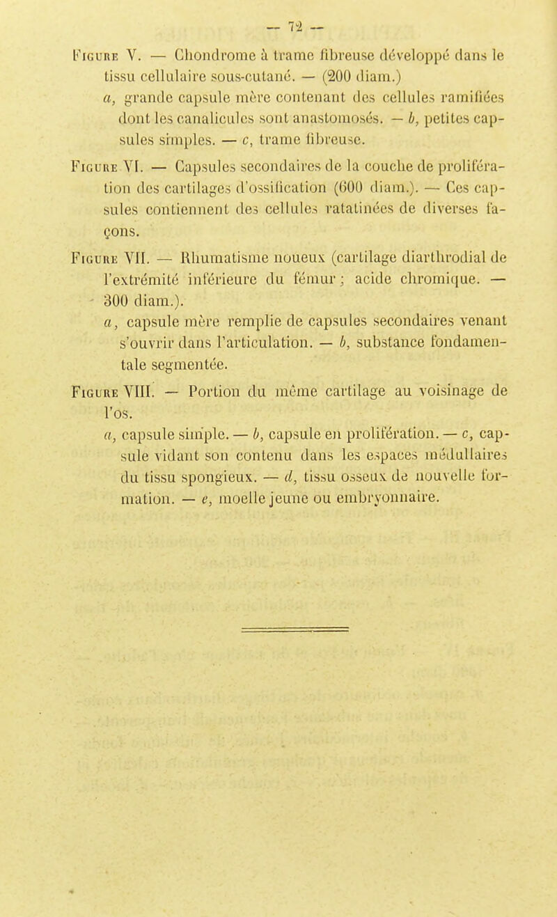Figure V. — Chondrome à trame fibreuse développé dans le tissu cellulaire sous-outanc. — (200 diam.) a, grande capsule mère contenant des cellules ramifiées dont les canaliculcs sont anastomosés. — h, petites cap- sules simples. — c, trame fibreuse. Figure VI. — Capsules secondaires de la couche de proliféra- tion des cartilages d'ossification (600 diam.). — Ces cap- sules contiennent des cellules ratatinées de diverses fa- çons. Figure VU. — Rhumatisme noueux (cartilage diarthrodial de l'e.vtrémité inférieure du fémur; acide chromique. — 300 diam.). a, capsule mère remplie de capsules secondaires venant s'ouvrir dans Tarticulation. — h, substance fondamen- tale segmentée. Figure VIII. — Portion du même cartilage au voisinage de l'os. a, capsule simple. — h, capsule e)i prolifération. — c, cap- sule vidant son contenu dans les espaces médullaires du tissu spongieux. — d, tissu osseux de nouvelle for- mation. — e, moelle jeune ou embryonnaire.