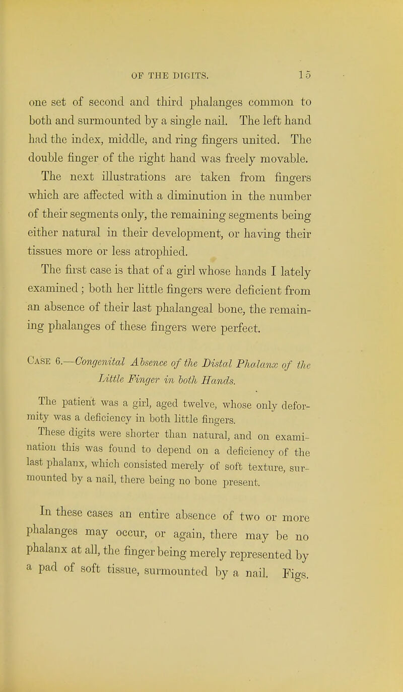 one set of second and third phalanges common to both and surmounted by a single nail. The left hand had the index, middle, and ring fingers united. The double finger of the right hand was freely movable. The next illustrations are taken from fingers which are affected with a diminution in the number of their segments only, the remaining segments being either natural in their development, or having their tissues more or less atrophied. The first case is that of a girl whose hands I lately examined; both her little fingers were deficient from an absence of their last phalangeal bone, the remain- ing phalanges of these fingers were perfect. Case 6.—Congenital Absence of the Distal Phalanx of the Little Finger in loth Hands. The patient was a girl, aged twelve, whose only defor- mity was a deficiency in both little fingers. These digits were shorter than natural, and on exami- nation this was found to depend on a deficiency of the last phalanx, which consisted merely of soft texture, sur- mounted by a nail, there being no bone present, In these cases an entire absence of two or more phalanges may occur, or again, there may be no phalanx at all, the finger being merely represented by a pad of soft tissue, surmounted by a nail. Figs.