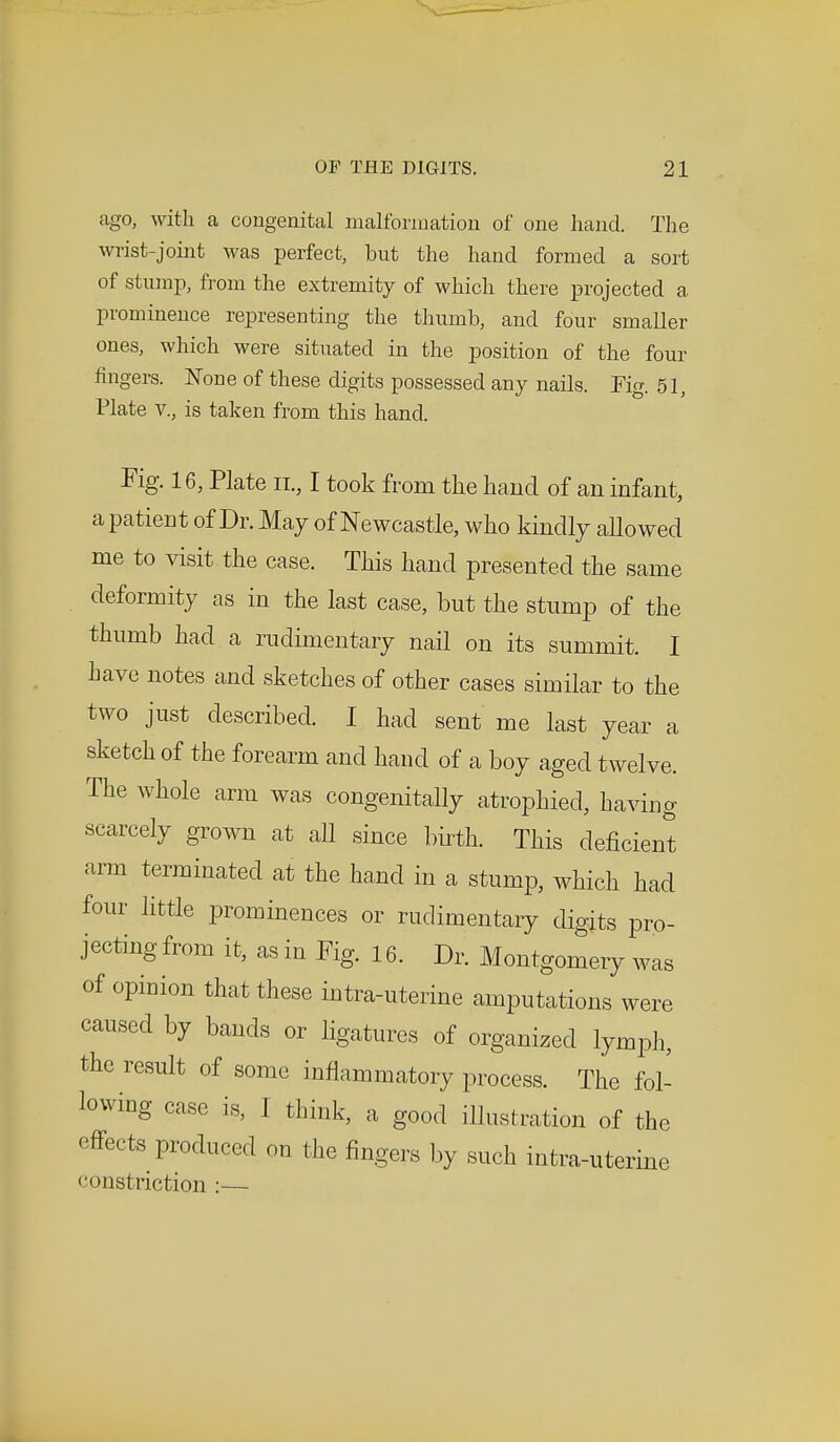 ago, with a congenital malformation of one hand. The wrist-joint was perfect, but the hand formed a sort of stump, from the extremity of which there projected a prominence representing the thumb, and four smaller ones, which were situated in the position of the four fingers. None of these digits possessed any nails. Fig. 51, Plate v., is taken from this hand. Fig. 16, Plate n., I took from the hand of an infant, a patient of Dr. May of Newcastle, who kindly allowed me to visit the case. This hand presented the same deformity as in the last case, but the stump of the thumb had a rudimentary nail on its summit. I have notes and sketches of other cases similar to the two just described. I had sent me last year a sketch of the forearm and hand of a boy aged twelve. The whole arm was congenially atrophied, having scarcely grown at all since birth. This deficient arm terminated at the hand in a stump, which had four little prominences or rudimentary digits pro- jecting from it, as in Fig. 16. Dr. Montgomery was of opinion that these intra-uterine amputations were caused by bands or ligatures of organized lymph, the result of some inflammatory process. The fol- lowing case is, I think, a good illustration of the effects produced on the fingers by such intra-uterine constriction :—