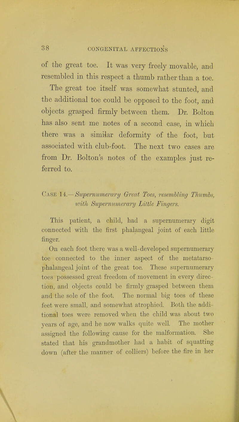 of the great toe. It was veiy freely movable, and resembled in this respect a thumb rather than a toe. The great toe itself was somewhat stunted, and the additional toe could be opposed to the foot, and objects grasped firmly between them. Dr. Bolton has also sent me notes of a second case, in which there was a similar deformity of the foot, but associated with club-foot. The next two cases are from Dr. Bolton's notes of the examples just re- ferred to. Case 14.— Supernumerary Great Toes, resembling Thumbs, with Supernumerary Little Fingers. This patient, a child, had a supernumerary digit connected with the first phalangeal joint of each little finger. On each foot there was a well-developed supernumerary toe connected to the inner aspect of the metatarso- phalangeal joint of the great toe. These supernumerary toes possessed great freedom of movement in every direc- tion, and objects could be firmly grasped between them and the sole of the foot. The normal big toes of these feet were small, and somewhat atrophied. Both the addi- tional toes were removed when the child was about two years of age, and he now walks quite well. The mother assigned the following cause for the malformation. She stated that his grandmother had a habit of squatting down (after the manner of colliers) before the fire in her