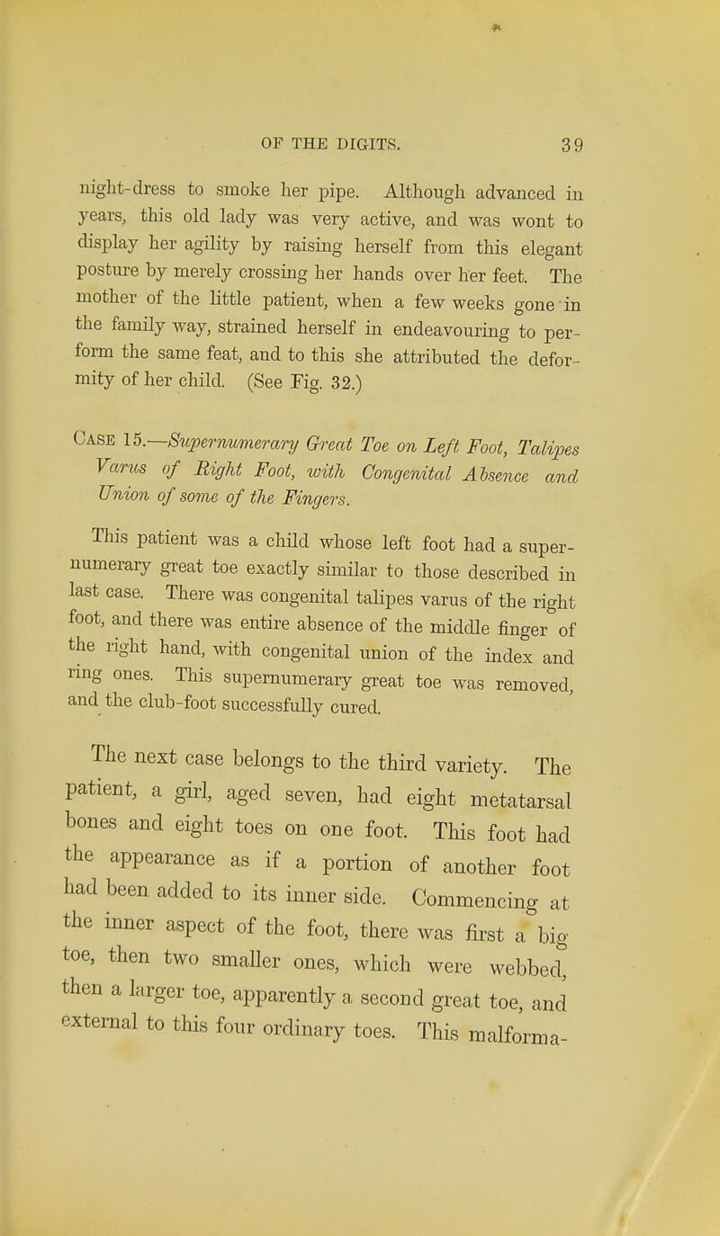night-dress to smoke her pipe. Although advanced in years, this old lady was very active, and was wont to display her agility by raising herself from this elegant posture by merely crossing her hands over her feet. The mother of the little patient, when a few weeks gone in the family way, strained herself in endeavouring to per- form the same feat, and to this she attributed the defor- mity of her child. (See Fig. 32.) Case 15.—Supernumerary Great Toe on Left Foot, Talipes Varus of Right Foot, with Congenital Absence and Union of some of the Fingers. This patient was a child whose left foot had a super- numerary great toe exactly similar to those described in last case. There was congenital talipes varus of the right foot, and there was entire absence of the middle finger of the right hand, with congenital union of the index and ring ones. This supernumerary great toe was removed, and the club-foot successfully cured. The next case belongs to the third variety. The patient, a girl, aged seven, had eight metatarsal bones and eight toes on one foot. This foot had the appearance as if a portion of another foot had been added to its inner side. Commencing at the inner aspect of the foot, there was first a big- toe, then two smaller ones, which were webbed^ then a larger toe, apparently a second great toe, and external to this four ordinary toes. This malforma-
