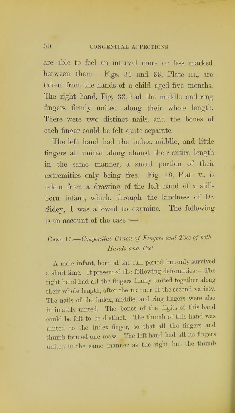 are able to feel an interval more or less marked between them. Figs. 31 and 33, Plate in., are taken from the hands of a child aged five months. The right hand, Fig. 33, had the middle and ring fingers firmly united along their whole length. There were two distinct nails, and the bones of each finger could be felt quite separate. The left hand had the index, middle, and little fingers all united along almost their entire length in the same manner, a small portion of their extremities only being free. Fig. 48, Plate v., is taken from a drawing of the left hand of a still- born infant, which, through the kindness of Dr. Sidey, I was allowed to examine. The folio wing- is an account of the case :— Case 17.—Congenital Union of Fingers and Toes of both Hands and. Feet. A male infant, born at the full period, but only survived a short time. It presented the following deformities:—The right hand had all the fingers firmly united together along their whole length, after the manner of the second variety. The nails of the index, middle, and ring fingers were also intimately united. The bones of the digits of this hand could be felt to be distinct. The thumb of this hand was united to the index finger, so that all the fingers and thumb formed one mass. The left hand had aU its fingers united in the same manner as the right, but the thumb