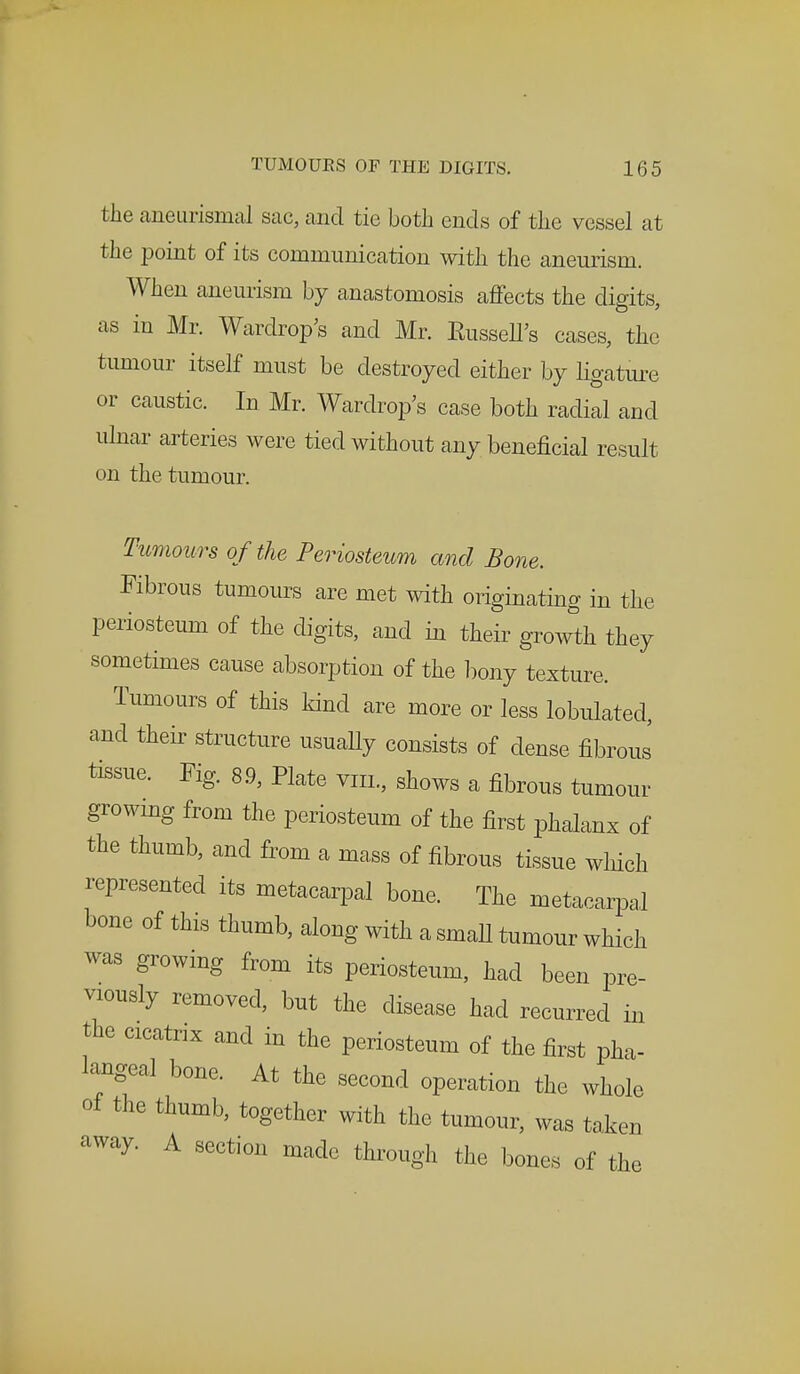 the aneurismal sac, and tie both ends of the vessel at the point of its communication with the aneurism. When aneurism by anastomosis affects the digits, as in Mr. Wardrop's and Mr. KusselTs cases, the tumour itself must be destroyed either by ligature or caustic. In Mr. Wardrop's case both radial and ulnar arteries were tied without any beneficial result on the tumour. Tumours of the Periosteum and Bone. Fibrous tumours are met with originating in the periosteum of the digits, and in their growth they sometimes cause absorption of the bony texture. Tumours of this kind are more or less lobulated, and their structure usually consists of dense fibrous tissue. Fig. 8.9, Plate vm, shows a fibrous tumour growing from the periosteum of the first phalanx of the thumb, and from a mass of fibrous tissue which represented its metacarpal bone. The metacarpal bone of this thumb, along with a small tumour which was growing from its periosteum, had been pre- viously removed, but the disease had recurred in the cicatrix and in the periosteum of the first pha- langeal bone. At the second operation the whole of the thumb, together with the tumour, was taken away. A section made through the bones of the