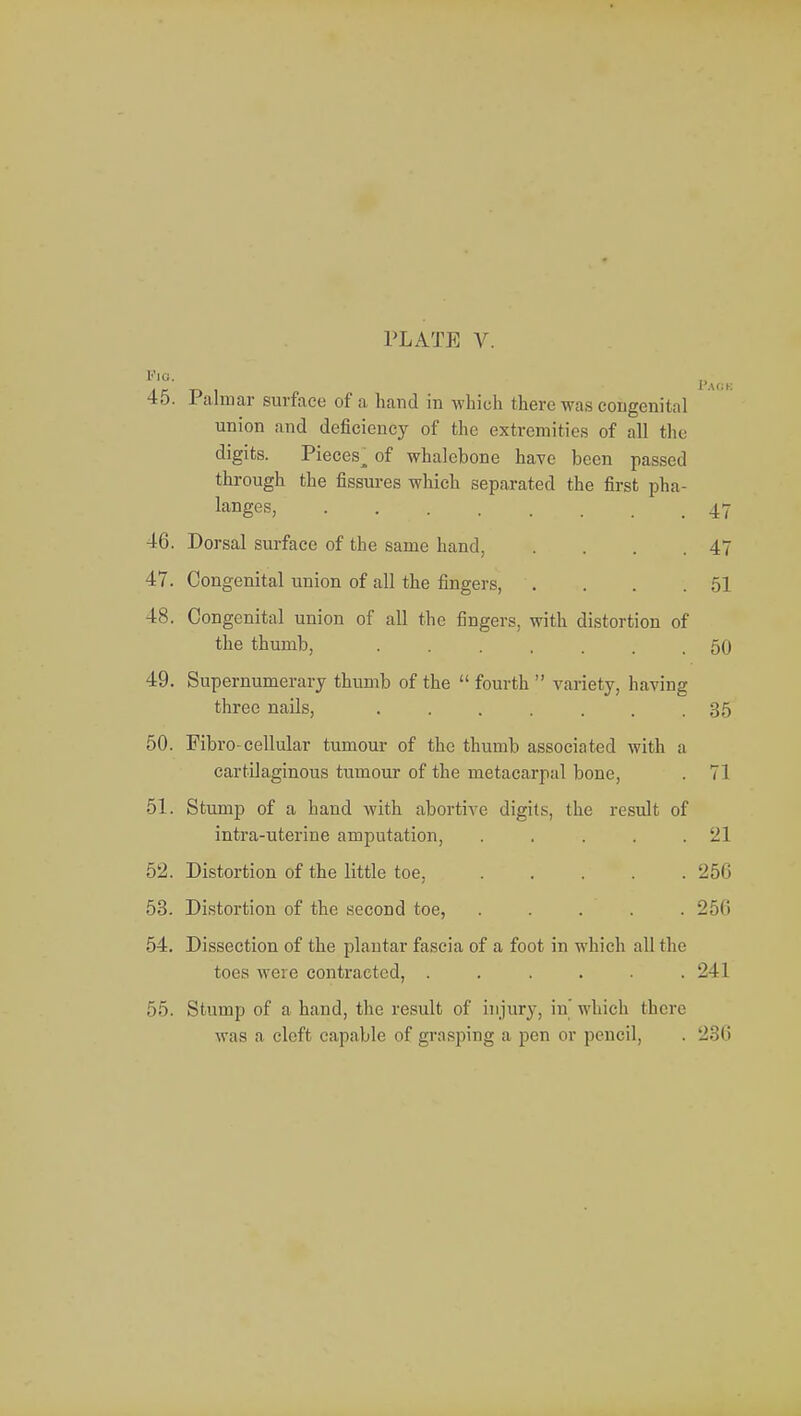 Pie, _ 45. 1 almar surface of a hand in which there was congenita] union and deficiency of the extremities of all the digits. Pieces^ of whalebone have been passed through the fissures which separated the first pha- langes, . . 47 46. Dorsal surface of the same hand, . . . .47 47. Congenital union of all the fingers, . . . .51 48. Congenital union of all the fingers, with distortion of the thumb, ....... 50 49. Supernumerary thumb of the  fourth  variety, having three nails, ....... 35 50. Fibro-cellular tumour of the thumb associated with a cartilaginous tumour of the metacarpal bone, . 71 51. Stump of a hand with abortive digits, the result of intra-uterine amputation, . . . . . '21 52. Distortion of the little toe, ..... 256 53. Distortion of the second toe, ..... 256 54. Dissection of the plantar fascia of a foot in which all the toes were contracted, ...... 241 55. Stump of a hand, the result of injury, in which there was a cleft capable of grasping a pen or pencil, . 236