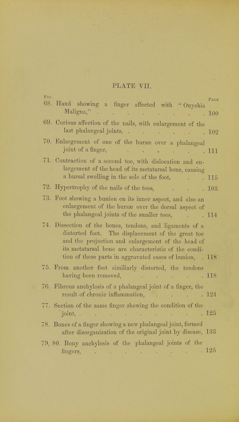 £'0 tt Page 08. Hand showing a finger affected with  Onychia Maligna, 100 69. Curious affection of the nails, with enlargement of the last phalangeal joints, ...... 102 70. Enlargement of one of the burste over a phalangeal joint of a finger, ...... Ill 71. Contraction of a second toe, with dislocation and en- largement of the head of its metatarsal bone, causing a bursal swelling in the sole of the foot, . .115 72. Hypertrophy of the nails of the toes, . . . 103 73. Foot showing a bunion on its inner aspect, and also an enlargement of the bursas over the dorsal aspect of the phalangeal joints of the smaller toes, . . 114 74. Dissection of the bones, tendons, and ligaments of a distorted foot. The displacement of the great toe and the projection and enlargement of the head of its metatarsal bone are characteristic of the condi- tion of these parts in aggravated cases of bunion, . 118 75. From another foot similiarly distorted, the tendons having been removed, ..... 118 71 i. Fibrous anchylosis of a phalangeal joint of a finger, the result of chronic inflammation, . . . . 124 77. Section of the same finger showing the condition of tin' joint, '. . . 125 78. Bones of a finger showing a new phalangeal joint, formed after disorganization of the original joint by disease, 133 79. 80. Bony anchylosis of the phalangeal joints of the fingers, 125