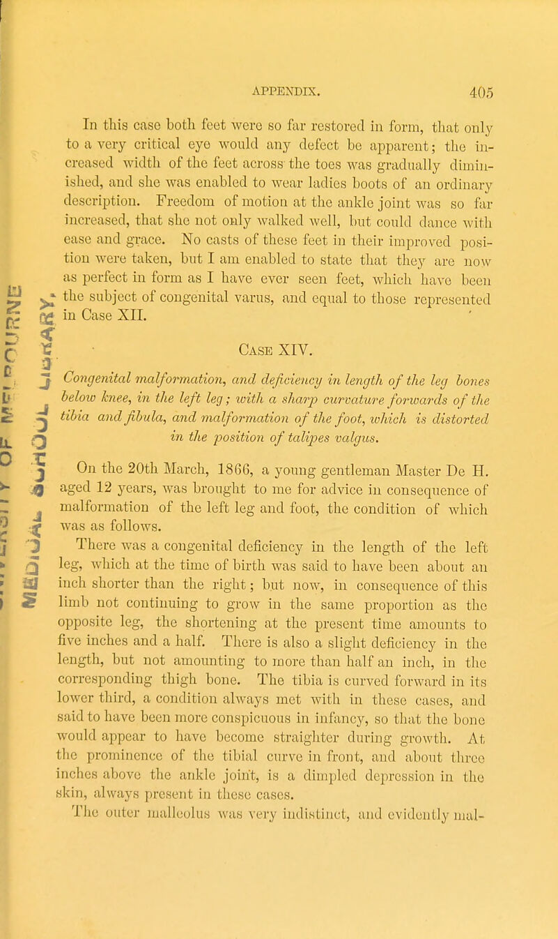 In this case both feet were so far restored in form, that only to a very critical eye would any defect be apparent; the in- creased width of the feet across- the toes was gradually dimin- ished, and she was enabled to wear ladies boots of an ordinary description. Freedom of motion at the ankle joint was so far increased, that she not only Avalked well, but could dance with ease and grace. No casts of these feet in their improved posi- tion were taken, but I am enabled to state that they are now as perfect in form as I have ever seen feet, which have been ^ the subject of congenital varus, and equal to those represented (Ig in Case XII. r Case XIV. J Congenital malformation, and deficiency in length of the leg bones below knee, in the left leg; with a sharp curvature forwards of the ^ tibia and fibula, and malformation of the foot, which is distorted in the position of talipes valgus. T J On the 20th March, 1866, a young gentleman Master De H. <Q aged 12 years, was brought to me for advice in consequence of J malformation of the left leg and foot, the condition of which ^ was as follows, i There was a congenital deficiency in the length of the left leg, which at the time of birth was said to have been about an inch shorter than the right; but now, in consequence of this limb not continuing to grow in the same proportion as the opposite leg, the shortening at the present time amounts to five inches and a half. There is also a sliglit deficiency in the length, but not amounting to more than half an inch, in the corresponding thigh bone. The tibia is curved forward in its lower third, a condition always met with in these cases, and said to have been more conspicuous in infancy, so that the bone would appear to have become straighter during growth. At the pro7nincnce of the tibial curve in front, and about three inches above the ankle joint, is a dimpled depression in the skin, always present in these cases. The outer malleolus was very indistinct, and evidently nuil-