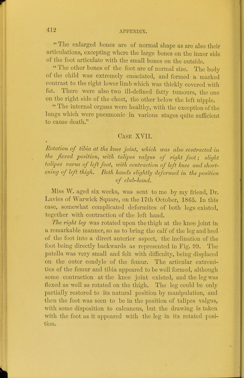The enlarged bones arc of normal shape as are also their articulations, excepting where the large bones on the inner side of the foot articulate with the small bones on the outside. The other bones of the foot are of normal size. The body of the child was extremely emaciated, and formed a marked contrast to the right lower limb which was thickly covered vnth. fat. There were also two ill-defined fatty tumours, the one on the right side of the chest, the other below the left nipple. The internal organs were healthy, with the exception of the lungs which were pneumonic in various stages quite sufficient to cause death. Case XVII. » Rotation of tibia at the hnee joint, which was also contracted in the flexed position, with tali23es valgus of right foot; slight talipes varus of left foot, toith contraction of left knee and short- ening of left thigh. Both hands slightly deformed in the position of cluh-hand. Miss W. aged six weeks, was sent to me by my friend, Dr. Lavies of Warwick Square, on the 17th October, 1865. In this case, somewhat complicated deformites of both legs existed, together with contraction of the left hand. The right leg was rotated upon the thigh at the knee joint in a remarkable manner, so as to bring the calf of the leg and heel of the foot into a direct anterior aspect, the inclination of the foot being directly backwards as represented in Fig. 99. The patella was very small and felt with difficulty, being displaced on the outer condyle of the femur. The articular extremi- ties of the femur and tibia appeared to be well formed, although some contraction at the knee joint existed, and the leg was flexed as well as rotated on the thigh. The leg could be only partially restored to its natural position by manipulation, and then the foot was seen to be in the position of talipes valgus, with some disposition to calcaneus, but the drawing is taken with the foot as it appeared with the leg in its rotated posi- tion.