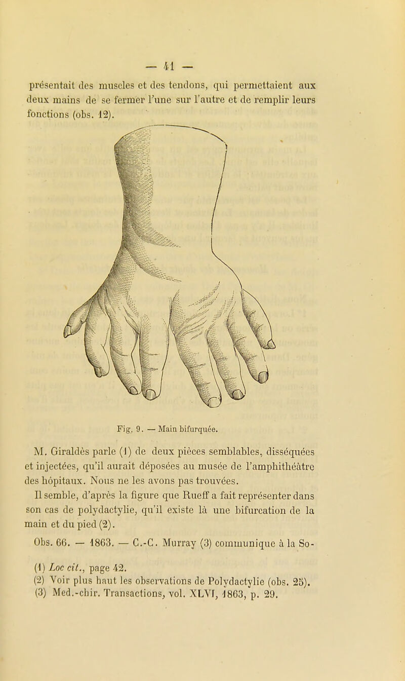 présentait des muscles et des tendons, qui permettaient aux deux mains de se fermer Fune sur l'autre et de remplir leurs fonctions (obs. 12). Fig', 9. — Main bifurquée. M. Giraldès parle (1) de deux pièces semblables, disséquées et injectées, qu'il aurait déposées au musée de l'amphithéâtre des hôpitaux. Nous ne les avons pas trouvées. Il semble, d'après la figure que Rueff a fait représenter dans son cas de polydactyUe, qu'il existe là une bifurcation de la main et du pied (2). Obs. 66. - 1863. — C.-C. Murray (3) communique à la So- (1) Loc cit., page 42. (2) Voir plus haut les observations de Polydactylie (obs. 25). (3) Med.-chir. Transactions, vol. XLVf, 1863, p. 29.