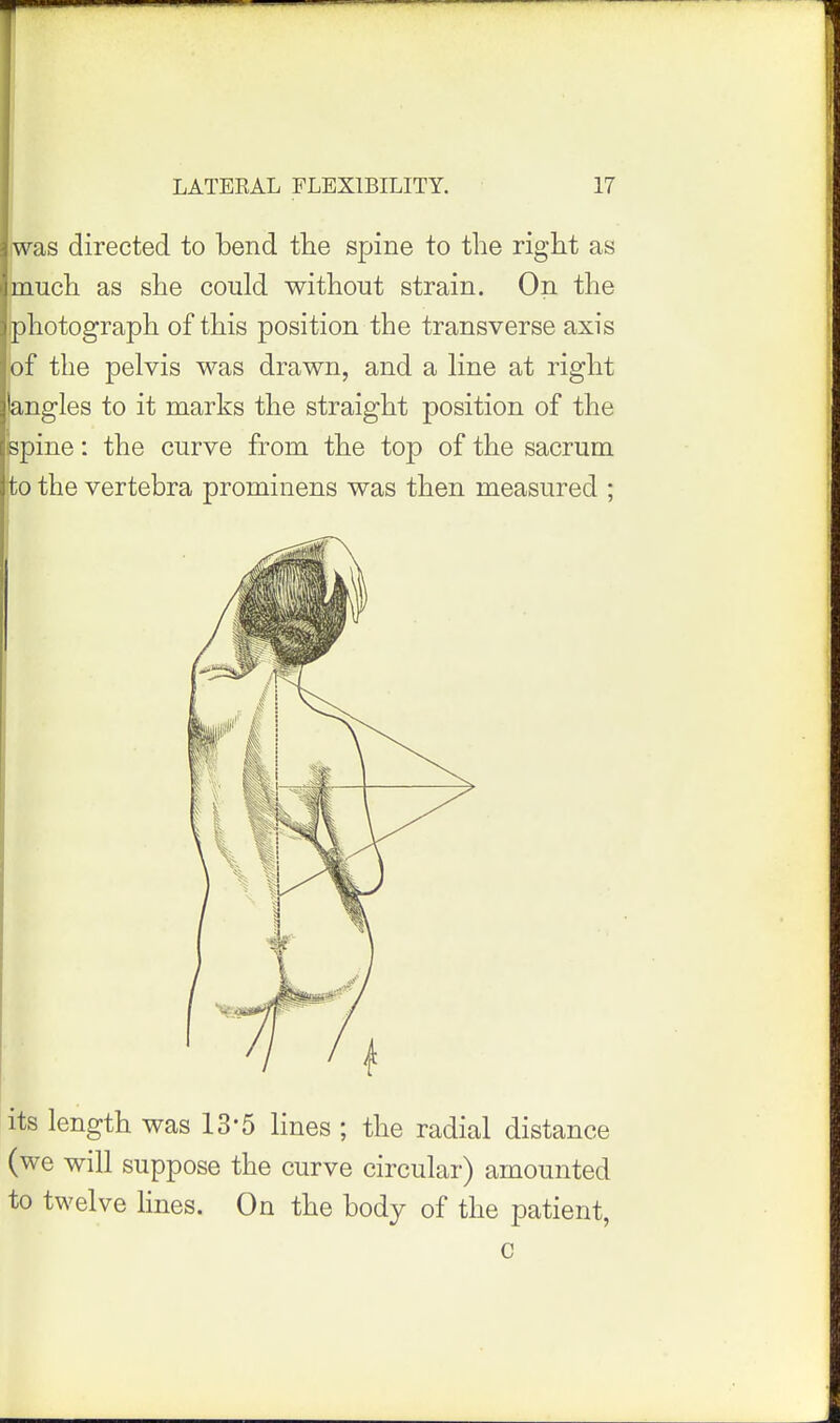 iwas directed to bend the spine to the right as Dauch as she could without strain. On the photograph of this position the transverse axis of the pelvis was drawn, and a line at right angles to it marks the straight position of the spine: the curve from the top of the sacrum to the vertebra prominens was then measured ; its length was 13*5 lines ; the radial distance (we will suppose the curve circular) amounted to twelve lines. On the body of the patient, c