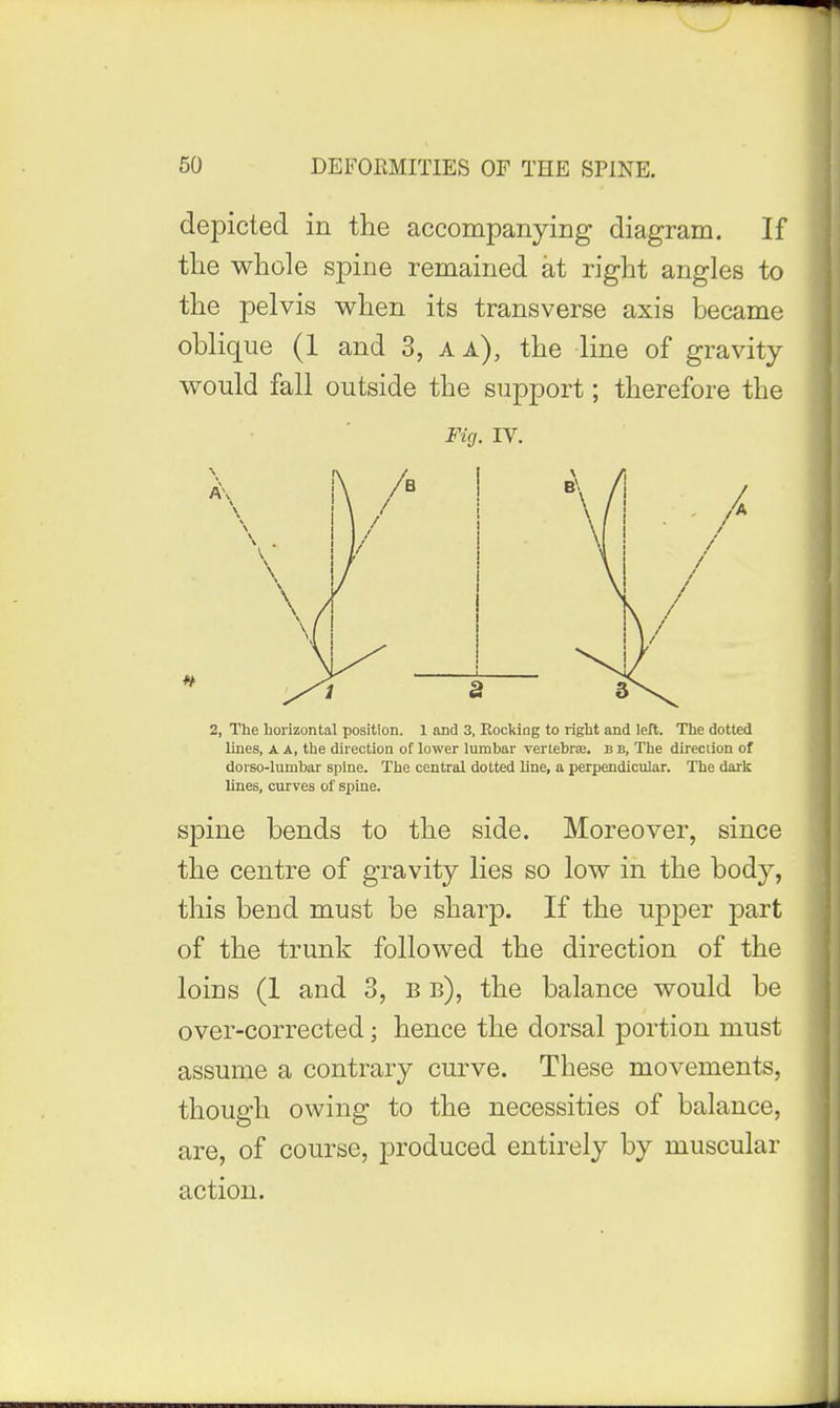depicted in the accompanying diagram. If the whole spine remained at right angles to the pelvis when its transverse axis became oblique (1 and 3, a a), the line of gravity would fall outside the support; therefore the Fig. IV. 2, The horizontal position. 1 and 3, EocI<ing to right and left. The dotted lines, A A, the direction of lower lumbar verlebrEe. b b. The direction of dorso-lumbar spine. The central dotted line, a perpendicular. The dark lines, curves of spine. spine bends to the side. Moreover, since the centre of gravity lies so low in the body, this bend must be sharp. If the upper part of the trunk followed the direction of the loins (1 and 3, b b), the balance would be over-corrected; hence the dorsal portion must assume a contrary curve. These movements, though owing to the necessities of balance, are, of course, produced entirely by muscular action.