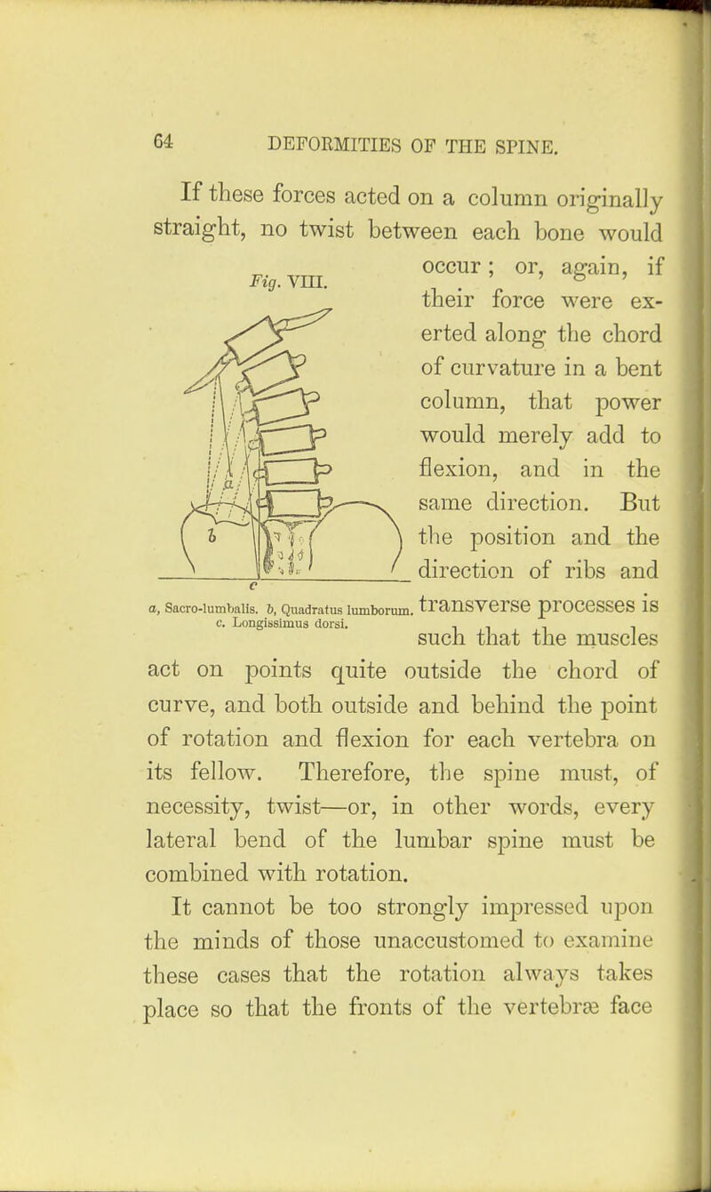 Fig. Vm. If these forces acted on a column originally straight, no twist between each bone would occur; or, again, if their force were ex- erted along the chord of curvature in a bent column, that power would merely add to flexion, and in the same direction. But the position and the direction of ribs and a, Sacro-lumbalis. &, Quadratus lumborum. tranSVCrSC prOCCSSCS IS c. Longissimus dorsi. . . . - such that the muscles act on points quite outside the chord of curve, and both outside and behind the point of rotation and flexion for each vertebra on its fellow. Therefore, the spine must, of necessity, twist—or, in other words, every lateral bend of the lumbar spine must be combined with rotation. It cannot be too strongly impressed upon the minds of those unaccustomed to examine these cases that the rotation always takes place so that the fronts of the vertebrae face