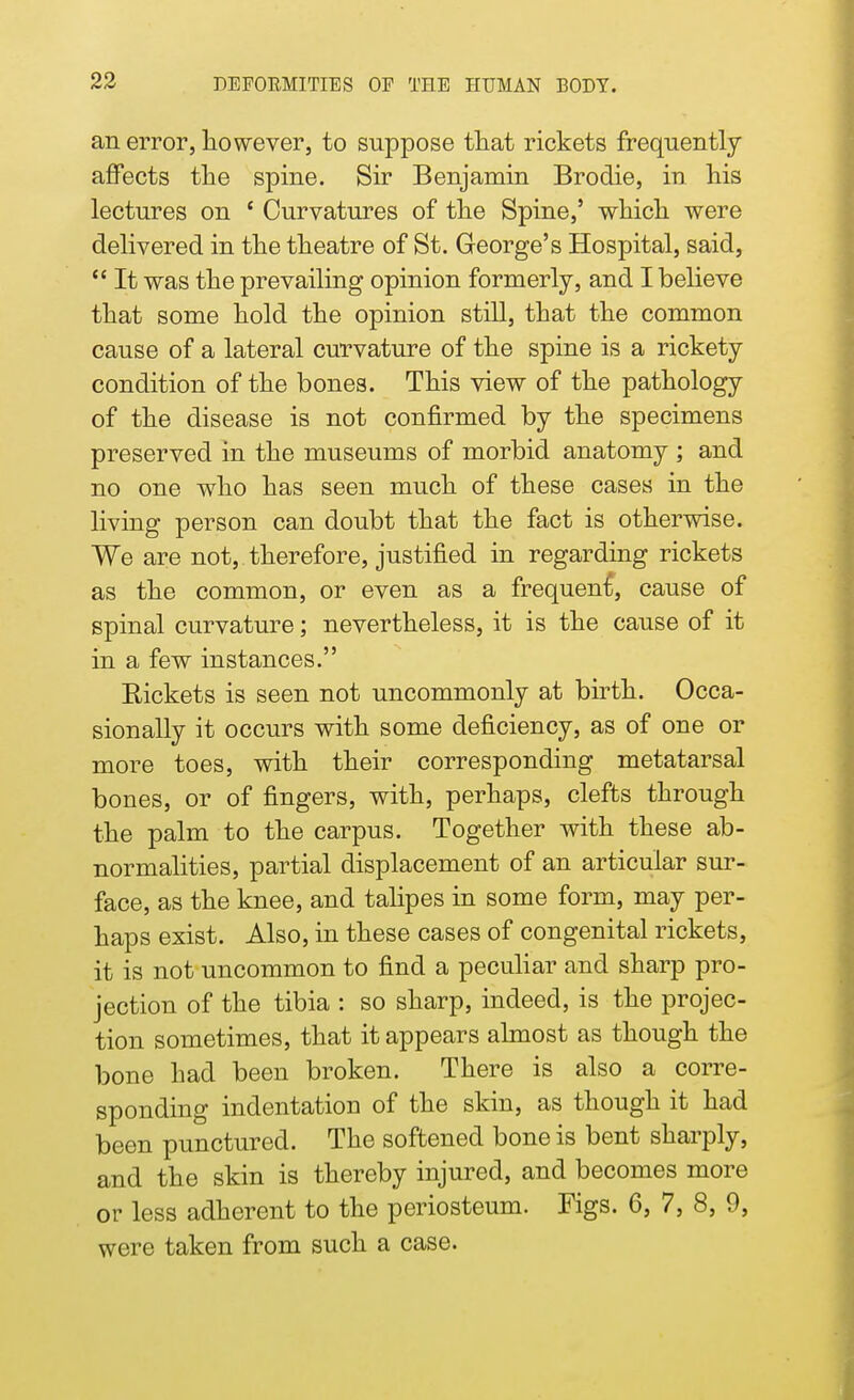 an error, however, to suppose that rickets frequently affects the spine. Sir Benjamin Brodie, in his lectures on ' Curvatures of the Spine,' which were delivered in the theatre of St. George's Hospital, said,  It was the prevailing opinion formerly, and I believe that some hold the opinion still, that the common cause of a lateral curvature of the spine is a rickety condition of the bones. This view of the pathology of the disease is not confirmed by the specimens preserved in the museums of morbid anatomy ; and no one who has seen much of these cases in the living person can doubt that the fact is otherwise. We are not, therefore, justified in regarding rickets as the common, or even as a frequent, cause of spinal curvature; nevertheless, it is the cause of it in a few instances. Eickets is seen not uncommonly at birth. Occa- sionally it occurs with some deficiency, as of one or more toes, with their corresponding metatarsal bones, or of fingers, with, perhaps, clefts through the palm to the carpus. Together with these ab- normalities, partial displacement of an articular sur- face, as the knee, and talipes in some form, may per- haps exist. Also, in these cases of congenital rickets, it is not uncommon to find a peculiar and sharp pro- jection of the tibia : so sharp, indeed, is the projec- tion sometimes, that it appears almost as though the bone had been broken. There is also a corre- sponding indentation of the skin, as though it had been punctured. The softened bone is bent sharply, and the skin is thereby injured, and becomes more or less adherent to the periosteum. Figs. 6, 7, 8, 9, were taken from such a case.