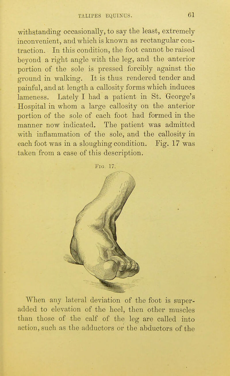 withstanding occasionally, to say the least, extremely inconvenient, and which is known as rectangular con- traction. In this condition, the foot cannot be raised beyond a right angle with the leg, and the anterior portion of the sole is pressed forcibly against the ground in walking. It is thus rendered tender and painful, and at length a callosity forms which induces lameness. Lately I had a patient in St. George's Hospital in whom a large callosity on the anterior portion of the sole of each foot had formed in the manner now indicated. The patient was admitted with inflammation of the sole, and the callosity in each foot was in a sloughing condition. Fig. 17 was taken from a case of this description. Fig. 17. When any lateral deviation of the foot is super- added to elevation of the heel, then other muscles than those of the calf of the leg are called into action, such as the adductors or the abductors of the