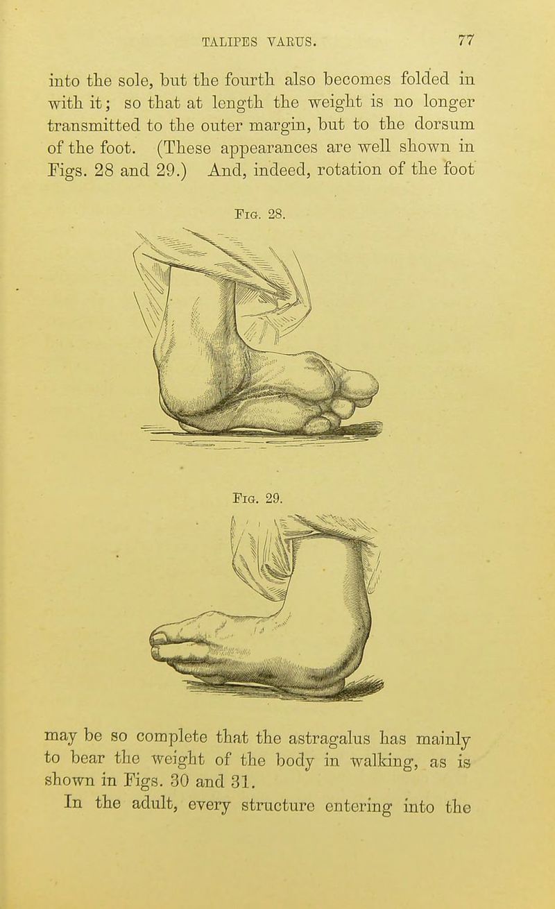 into the sole, but the fourth also becomes folded in with it; so that at length the weight is no longer transmitted to the outer margin, but to the dorsum of the foot. (These appearances are well shown in Figs. 28 and 29.) And, indeed, rotation of the foot' Fig. 28. may be so complete that the astragalus has mainly to bear the weight of the body in walking, as is shown in Figs. 30 and 31. In the adult, every structure entering into the
