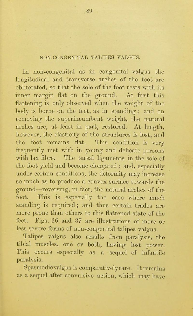 NON-CONGENITAL TALIPES VALGUS. In non-congenital as in congenital valgus the longitudinal and transverse arches of the foot are obliterated, so that the sole of the foot rests with its inner margin flat on the ground. At first this flattening is only observed when the weight of the body is borne on the feet, as in standing; and on removing the superincumbent weight, the natural arches are, at least in part, restored. At length, however, the elasticity of the structures is lost, and the foot remains flat. This condition is very frequently met with in young and delicate persons with lax fibre. The tarsal ligaments in the sole of the foot yield and become elongated; and, especially under certain conditions, the deformity may increase so much as to produce a convex surface towards the ground—reversing, in fact, the natural arches of the foot. This is especially the case where much standing is required; and thus certain trades are more prone than others to this flattened state of the feet. Figs. 36 and 37 are illustrations of more or less severe forms of non-congenital talipes valgus. Talipes valgus also results from paralysis, the tibial muscles, one or both, having lost power. This occurs especially as a sequel of infantile paralysis. Spasmodicvalgus is comparatively rare. It remains as a sequel after convulsive action, which may have