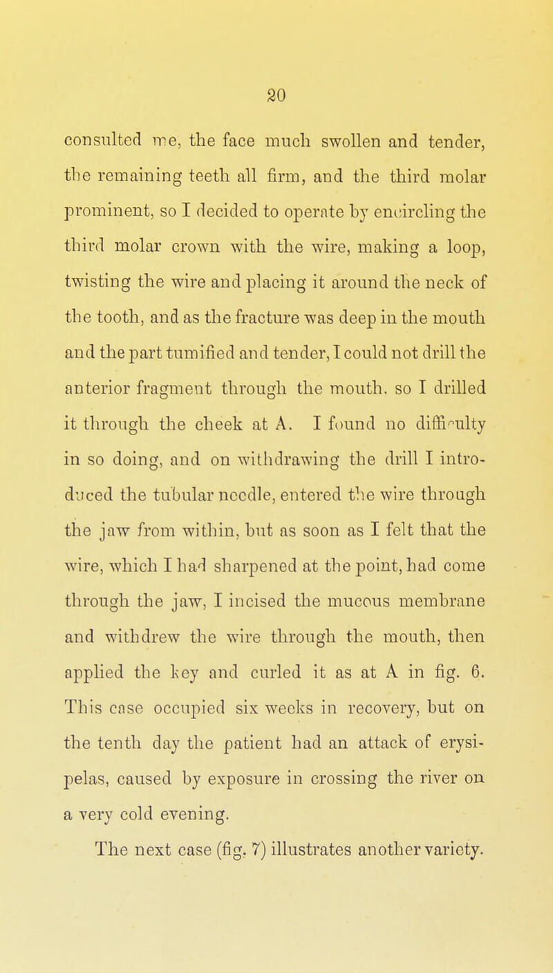 consulted me, the face much swollen and tender, the remaining teeth all firm, and the third molar prominent, so I decided to operate hy emdrcling the third molar crown with the wire, making a loop, twisting the wire and placing it around the neck of the tooth, and as the fracture was deep in the mouth and the part tumified and tender, I could not drill the anterior fragment through the mouth, so I drilled it through the cheek at A. I fi)und no diffi'^ulty in so doing, and on withdrawing the drill I intro- duced the tubular needle, entered the wire through the jaw from within, but as soon as I felt that the wire, which I had sharpened at the point, had come through the jaw, I incised the mucous membrane and withdrew the wire through the mouth, then apphed the key and curled it as at A in fig. 6. This case occupied six weeks in recovery, but on the tenth day the patient had an attack of erysi- pelas, caused by exposure in crossing the river on a very cold evening. The next case (fig. 7) illustrates another variety.