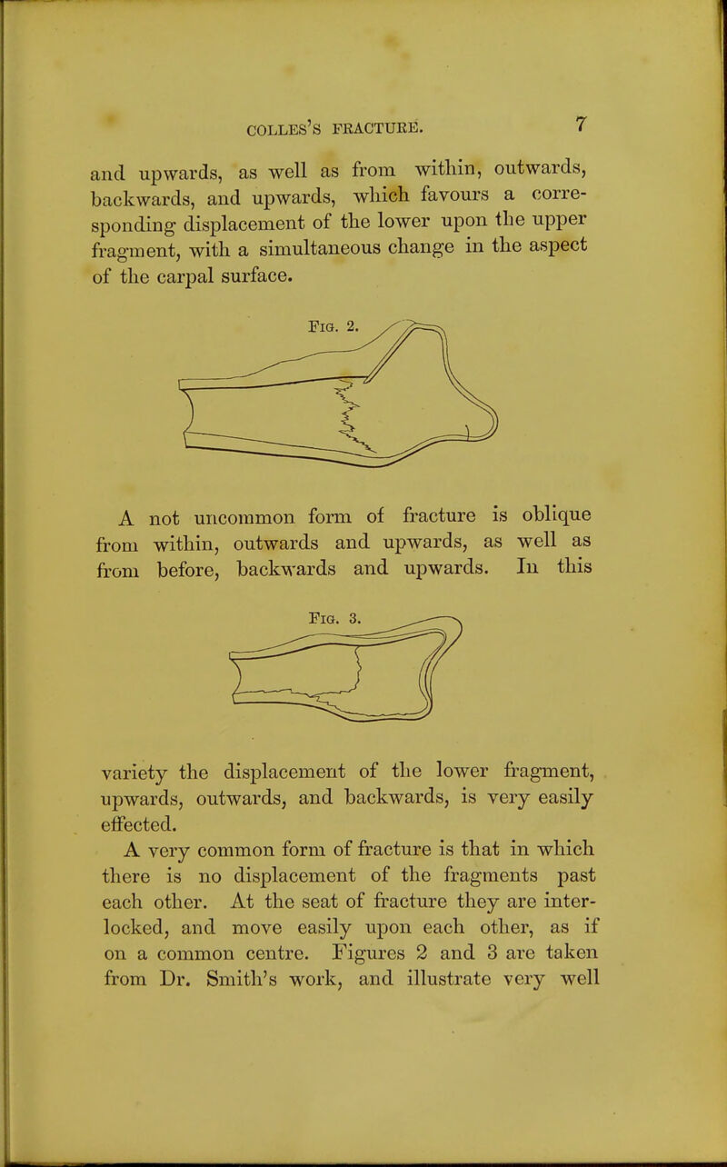 and upwards, as well as from within, outwards, backwards, and upwards, which favours a corre- sponding displacement of the lower upon the upper fragment, with a simultaneous change in the aspect of the carpal surface. A not uncommon form of fracture is oblique from within, outwards and upwards, as well as from before, backwards and upwards. In this variety the displacement of the lower fragment, upwards, outwards, and backwards, is very easily effected. A very common form of fracture is that in which there is no displacement of the fragments past each other. At the seat of fracture they are inter- locked, and move easily upon each other, as if on a common centre. Figures 2 and 3 are taken from Dr. Smith's work, and illustrate very well