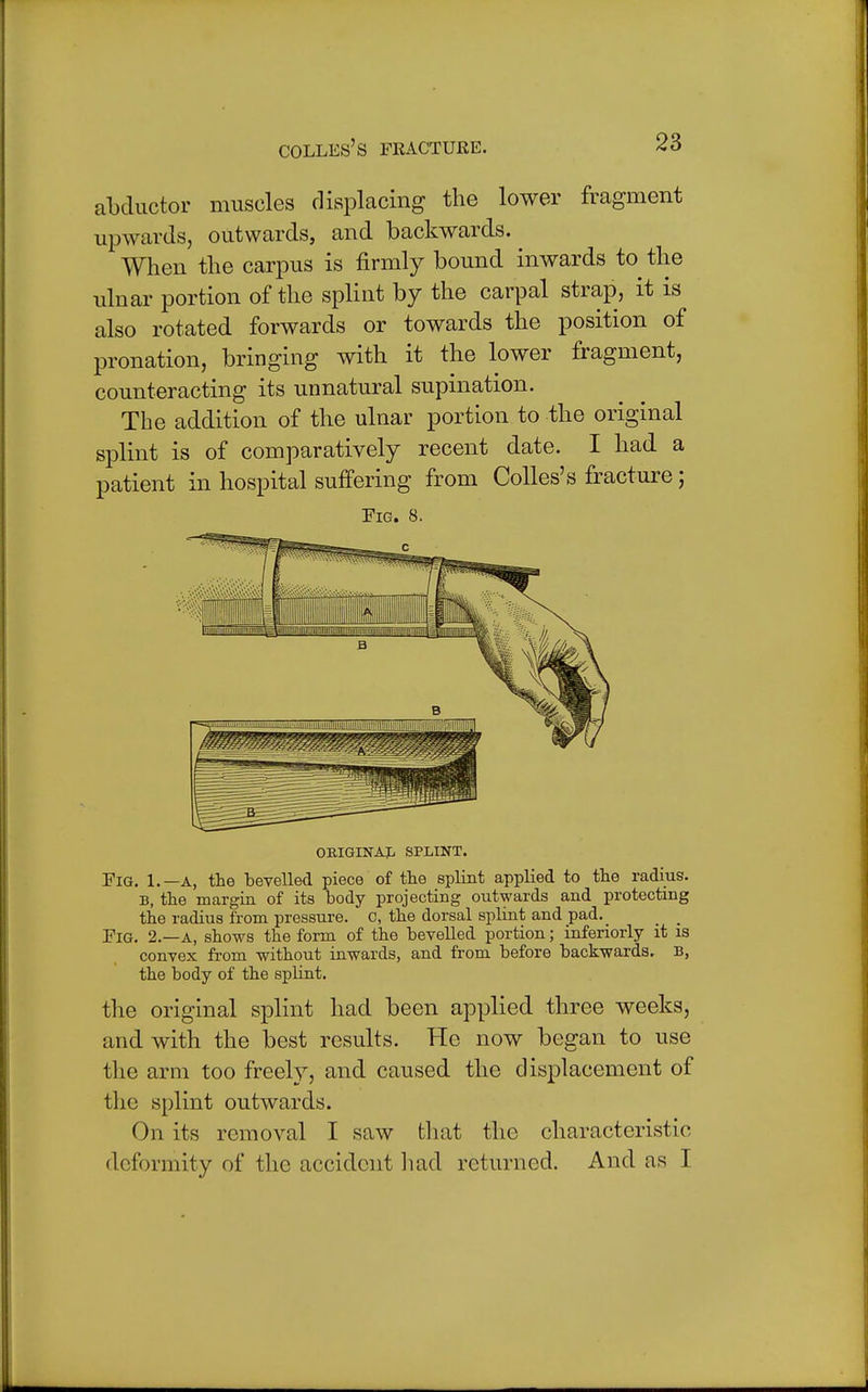 abductor muscles displacing the lower fragment upwards, outwards, and backwards. When the carpus is firmly bound inwards to the ulnar portion of the splint by the carpal strap, it is also rotated forwards or towards the position of pronation, bringing with it the lower fragment, counteracting its unnatural supination. The addition of the ulnar portion to the original splint is of comparatively recent date. I had a patient in hospital suffering from Colles's fracture; Fig. 8. iiiiiia'Fi.''''^ii| ill in ■ . in: , ORIGINAL SPLINT. Fig. 1.—a, the bevelled piece of the splint applied to the radius. B, the margin of its body projecting outwards and protecting the radius from pressure, c, the dorsal splint and pad. _ Fig. 2.—a, shows the form of the bevelled portion; inferiorly it is convex from without inwards, and from before backwards. B, the body of the splint. the original splint had been applied three weeks, and with the best results. He now began to use the arm too freely, and caused the displacement of the splint outwards. On its removal I saw that the characteristic deformity of the accident had returned. And as I