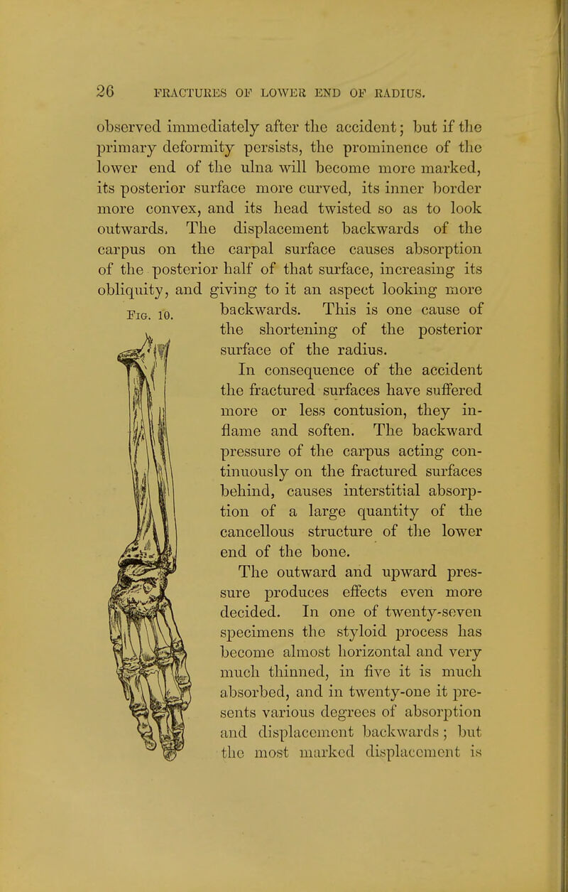 Fig. 10. observed immediately after tlie accident; but if the primary deformity persists, the prominence of the lower end of the ulna will become more marked, its posterior surface more curved, its inner border more convex, and its head twisted so as to look outwards, The displacement backwards of the carpus on the carpal surface causes absorption of the posterior half of that surface, increasing its obliquity, and giving to it an aspect looking more backwards. This is one cause of the shortening of the posterior surface of the radius. In consequence of the accident the fractured surfaces have suffered more or less contusion, they in- flame and soften. The backward pressure of the carpus acting con- tinuously on the fractured surfaces behind, causes interstitial absorp- tion of a large quantity of the cancellous structure of the lower end of the bone. The outward and upward pres- sure produces effects even more decided. In one of twenty-seven specimens the styloid process has become almost horizontal and very much thinned, in five it is much absorbed, and in twenty-one it pre- sents various degrees of absorption and displacement backwards ; but the most marked displacement is