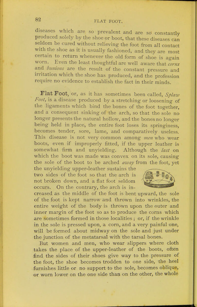 FLAT FOOT. diseases which are so prevalent and are so constantly produced solely by the shoe or boot, that these diseases can seldom be cured without relieving the foot from all contact with the shoe as it is usually fashioned, and they are most certain to return whenever the old form of shoe is again worn. Even the least thoughtful are well aware that corns and bunions are the result of the constant pressure and irritation which the shoe has produced, and the profession require no evidence to establish the fact in their minds. Flat Foot, or, as it has sometimes been called, Splaw Foot, is a disease produced by a stretching or loosening of the ligaments which bind the bones of the foot together, and a consequent sinking of the arch, so that the sole no longer presents the natural hollow, and the bones no longer being held in place, the entire foot loses its springiness, becomes tender, sore, lame, and comparatively useless. This disease is not very common among men who wear boots, even if improperly fitted, if the upper leather is somewhat firm and unyielding. Although the last on which the boot was made was convex on its sole, causing the sole of the boot to be arched away from the foot, yet the unyielding upper-leather sustains the two sides of the foot so that the arch is not broken down, and a flat foot seldom occurs. On the contrary, the arch is in- creased as the middle of the foot is bent upward, the sole of the foot is kept narrow and thrown into wrinkles, the entire weight of the body is thrown upon the outer and inner margin of the foot so as to produce the corns which are sometimes formed in those localities ; or, if the wrinkle in the sole is pressed upon, a corn, and a very painful one, will be formed about midway on the sole and just under the junction of the metatarsal with the tarsal bones. But women and men, who wear slippers where cloth takes the place of the upper-leather of the boots, often find the sides of their shoes give way to the pressure of the foot, the shoe becomes trodden to one side, the heel furnishes little or no support to the sole, becomes oblique, or worn lower on the one side than on the other, the whole