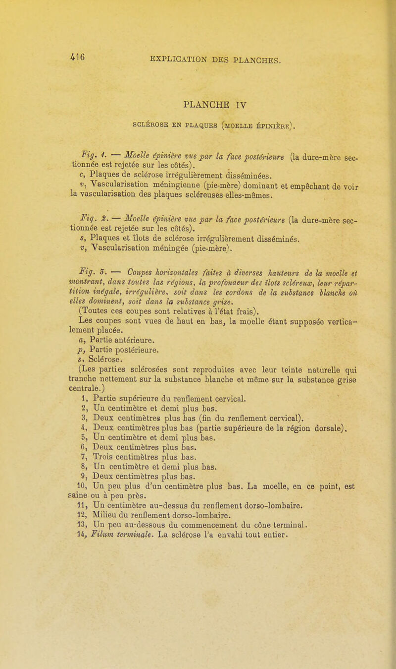 416 PLANCHE TV SCLÉROSE EN PLAQUES (kOELLE ÉPINIÈRk}. Fig. ■/. — Moelle épinière vue par la face postérieurs (la dure-mère sec- tionnée est rejetée sur les côtés), c, Plaques de sclérose irrégulièrement disséminées. V, Vascularisation méniugienne (pie-mère) dominant et empêchant de voir la vascularisation des plaques scléreuses elles-mSmes. Fiq. S. — Moelle épinière vue par la face postérieure (la dure-mère sec- tionnée est rejetée sur les côtés). s. Plaques et îlots de sclérose irrégulièrement disséminés. V, Vascularisation méningée (pie-mère\ Fig. S. — Coupes horizontales faites à diverses hauteurs de la moelle et montrant, dans toutes las régions, la profonaeur des îlots scléreuœ, leur répar- tition inégale, irrégulière, soit dans les cordons de la substance blanche oit elles dominent, soit dans la substance grise. (Toutes ces coupes sont relatives à l'état frais). Les coupes sont vues de haut en has, la moelle étant supposée vertica- lement placée. a, Partie antérieure. p. Partie postérieure. s. Sclérose. (Les parties sclérosées sont reproduites avec leur teinte naturelle qui tranche nettement sur la substance Hanche et même sur la substance grise centrale.) 1, Partie supérieure du renflement cervical. 2, Un centimètre et demi plus bas. 3, Deux centimètres plus bas (fin du renflement cervical). 4, Deux centimètres plus bas (partie supérieure de la région dorsale). 5, Un centimètre et demi plus bas. 6, Deux centimètres plus bas. 7, Trois centimètres plus bas. 8, Un centimètre et demi plus bas. 9, Deux centimètres plus bas. 10, Un peu plus d'un centimètre plus bas. La moelle, en ce point, est saine ou à peu près. 11, Un centimètre au-dessus du renflement dorso-lombaire. 12, Milieu du renflement dorso-lombaire. 13, Un peu au-dessous du commencement du cône terminal. 14, Filwm terminale. La sclérose l'a envahi tout entier.