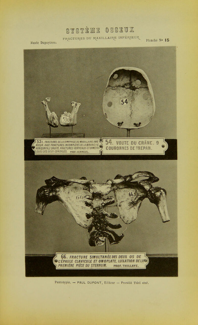 FP^ACTU^ES DU N^XILLAIF^E INFEP.IEUP^ ^ Musée Dupuytren.