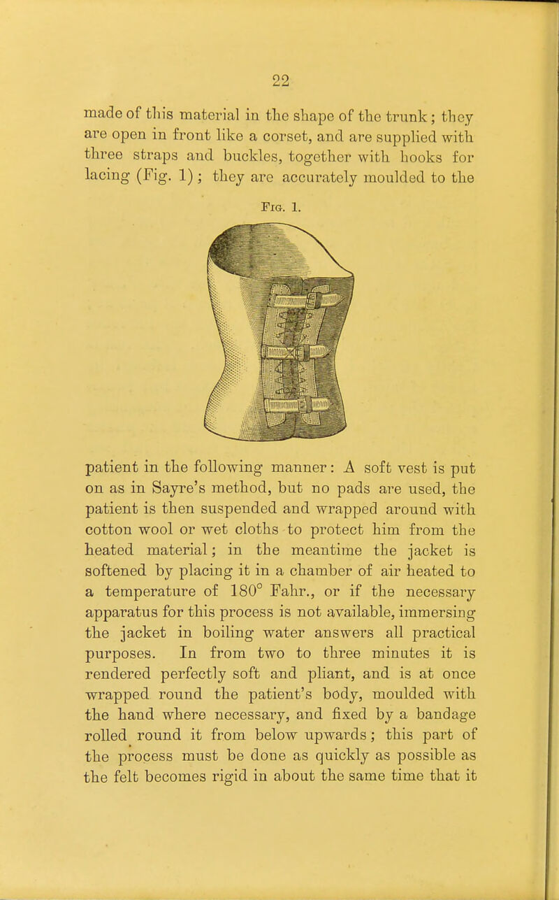 made of tin's material in tlie shape of the trunk; they are open in front like a corset, and are supplied with three straps and buckles, together with hooks for lacing (Fig. 1); they are accurately moulded to the Fig. 1. patient in the following manner: A soft vest is put on as in Sayre's method, but no pads are used, the patient is then suspended and wrapped around with cotton wool or wet cloths to protect him from the heated material; in the meantime the jacket is softened by placing it in a chamber of air heated to a temperature of 180° Fahr., or if the necessary apparatus for this process is not available, immersing the jacket in boiling water answers all practical purposes. In from two to three minntes it is rendered perfectly soft and pliant, and is at once wrapped round the patient's body, moulded with the hand where necessary, and fixed by a bandage rolled round it from below upwards; this part of the process must be done as quickly as possible as the felt becomes rigid in about the same time that it