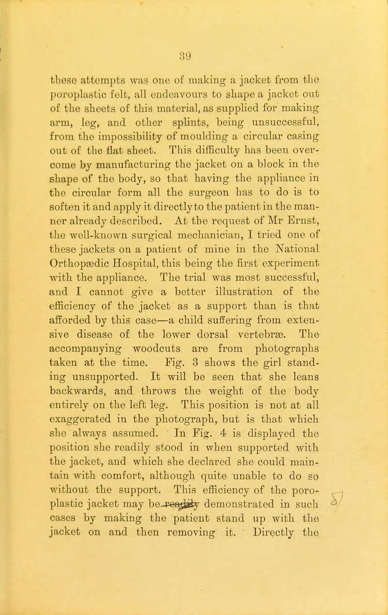 these attempts was one of making a jacket from the poroplastic felt, all endeavours to shape a jacket out of the sheets of this material, as siipplied for making arm, leg, and other splints, being unsuccessful, from the impossibility of moulding a circular casing out of the flat sheet. This difficulty has been over- come by manufacturing the jacket on a block in the shape of the body, so that having the appliance in the circular form all the surgeon has to do is to soften it and apply it directly to the patient in the man- ner already described. At the request of Mr Ernst, the well-known surgical mechanician, I tried one of these jackets on a patient of mine in the National Orthopaedic Hospital, this being the first experiment with the appliance. The trial was most successful, and I cannot give a better illustration of the efficiency of the jacket as a support than is that afforded by this case—a child suffering from exten- sive disease of the lower dorsal vertebrge. The accompanying woodcuts are from photographs taken at the time. Fig. 3 shows the girl stand- ing unsupported. It will be seen that she leans backwards, and throws the weight of the body entirely on the left leg. This position is not at all exaggerated in the photograph, but is that which she always assumed. In Fig. 4 is displayed the position she readily stood in when supported with the jacket, and which she declared she could main- tain with comfort, although quite unable to do so without the support. This efficiency of the poro- plastic jacket may be-iPe^a^ demonstrated in such cases by making the patient stand up with the jacket on and then removing it. Directly the