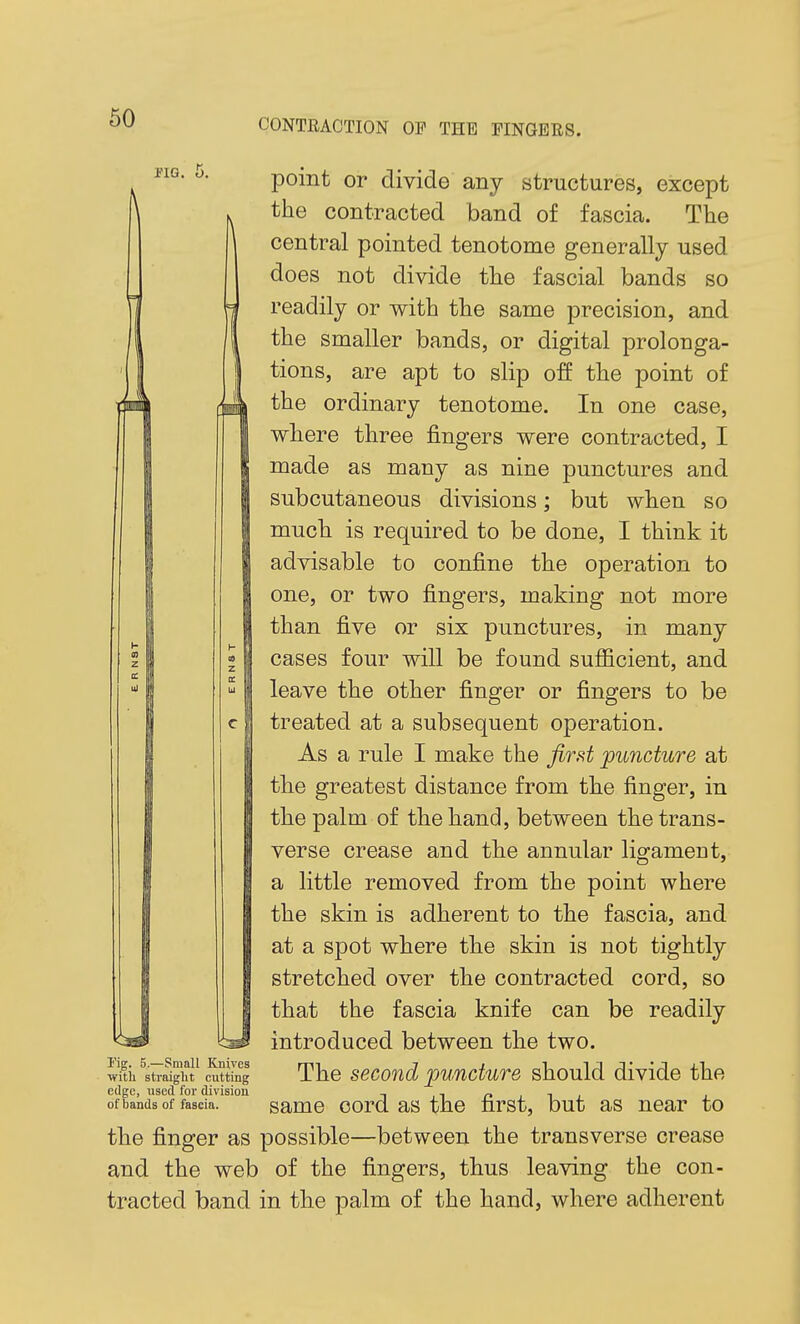 no. point or divide any structures, except the contracted band of fascia. The central pointed tenotome generally used does not divide the fascial bands so readily or with the same precision, and the smaller bands, or digital prolonga- tions, are apt to slip off the point of the ordinary tenotome. In one case, where three fingers were contracted, I made as many as nine punctures and subcutaneous divisions; but when so much is required to be done, I think it advisable to confine the operation to one, or two fingers, making not more than five or six punctures, in many cases four will be found sufficient, and leave the other finger or fingers to be treated at a subsequent operation. As a rule I make the first puncture at the greatest distance from the finger, in the palm of the hand, between the trans- verse crease and the annular ligament, a little removed from the point where the skin is adherent to the fascia, and at a spot where the skin is not tightly stretched over the contracted cord, so that the fascia knife can be readily introduced between the two. The second puncture should divide the same cord as the first, but as near to the finger as possible—between the transverse crease and the web of the fingers, thus leaving the con- tracted band in the palm of the hand, where adherent I'ig. 5.—Small Knives with straight cutting edge, used for division of bands of fascia.