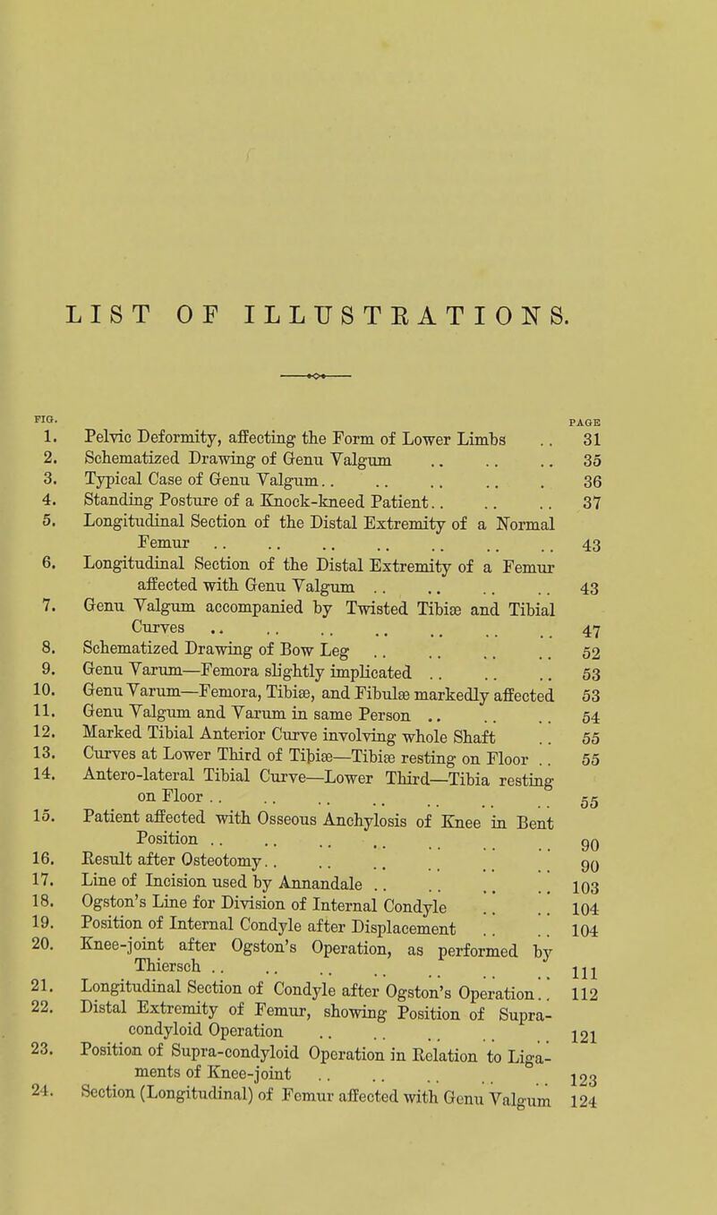 LIST OF ILLUSTRATIONS. •o- FIO- PAGE 1. Pelvic Deformity, affecting the Form of Lower Limbs .. 31 2. Schematized Drawing of Genu Valgum .. .. .. 35 3. Typical Case of Genu Valgum.. .. .. .. . 36 4. Standing Posture of a Knock-kneed Patient 37 5. Longitudinal Section of the Distal Extremity of a Normal Femur .. .. .. .. .. ,. .. 43 6. Longitudinal Section of the Distal Extremity of a Femur affected with Genu Valgum .. .. .. .. 43 7. Genu Valgum accompanied by Twisted Tibite and Tibial Curves .. .. .. ., tt _ 47 8. Schematized Drawing of Bow Leg .... 52 9. Genu Varum—Femora slightly implicated 53 10. Genu Varum—Femora, Tibiae, and Fibulae markedly affected 53 11. Genu Valgum and Varum in same Person 54 12. Marked Tibial Anterior Curve involving whole Shaft 55 13. Curves at Lower Third of Tibiae—Tibiee resting on Floor .. 55 14. Antero-lateral Tibial Curve—Lower Third—Tibia resting on Floor ........ 55 15. Patient affected with Osseous Anchylosis of Knee in Bent Position .. ■ • • • 16. Result after Osteotomy.. 17. Line of Incision used by Annandale 18. Ogston's Line for Division of Internal Condyle 19. Position of Internal Condyle after Displacement 20. Knee-joint after Ogston's Operation, as performed bj Thiersch .. .. .. . _ 2U 21. Longitudinal Section of Condyle after Ogston's Operation!' 112 22. Distal Extremity of Femur, showing Position of Supra- condyloid Operation 121 23. Position of Supra-condyloid Operation in Relation to Liga- ments of Knee-joint I23 24. Section (Longitudinal) of Femur affected with Genu Valgum 124 90 90 103 104 104