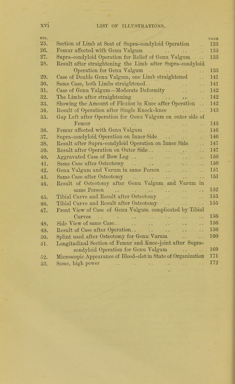 via. PAGE 25. Section of Limb at Seat of Supra-condyloid Operation . . 125 26. Femur affected with Genu Valgum .. .. .135 27. Supra-condyloid Operation for Relief of Genu Valgum .. 135 28. Result after straightening the Limb after Supra-condyloid Operation for Genu Valgum . . .. 135 29. Case of Double Genu Valgum, one Limb straightened .. 141 30. Same Case, both Limbs straightened.. .. 141 31. Case of Genu Valgum—Moderate Deformity .. .. 142 32. The Limbs after straightening .. .. . 142 33. Showing the Amount of Flexion in Knee after Operation .. 142 34. Result of Operation after Single Knock-knee .. 143 35. Gap Left after Operation for Genu Valgum on outer side of Femur .. .. .. .. .. .. .. 145 36. Femur affected with Genu Valgum . . . . . . 146 37. Supra-condyloid Operation on Inner Side .. 146 38. Result after Supra-condyloid Operation on Inner Side . . 147 39. Result after Operation on Outer Side.. .. . . 147 40. Aggravated Case of Bow Leg .. .. .. .. 150 41. Same Case after Osteotomy .. .. .. .. .. 150 42. Genu Valgum and Varum in same Person .. .. .. 151 43. Same Case after Osteotomy .. .. .. .. ..151 44. Result of Osteotomy after Genu Valgum and Varum in same Person .. .. .. .. .. .. 152 45. Tibial Curve and Result after Osteotomy .. .. .. 155 46. Tibial Curve and Result after Osteotomy .. .. .. 155 47. Front View of Case of Genu Valgum complicated by Tibial Curves .. . .. .. .. .. .. 156 48. Side View of same Case.. .. .. .. .. .. 156 49. Resrdt of Case after Operation.. 156 50. Splint used after Osteotomy for Genu Varum .. .. 160 51. Longitudinal Section of Femur and Knee-joint after Supra- condyloid Operation for Genu Valgum .. 169 52. Microscopic Appearance of Blood-clot in State of Organization 171 53. Same, high power .. .. 172