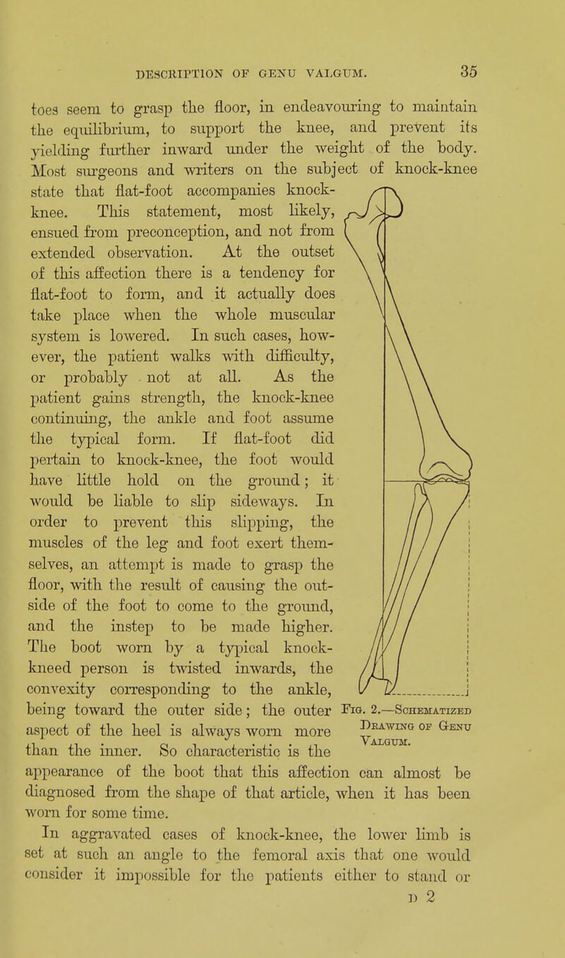 toes seem to grasp the floor, in endeavouring to maintain the equilibrium, to support the knee, and prevent its yielding further inward under the weight of the body. Most surgeons and writers on the subject of knock-knee state that flat-foot accompanies knock- knee. This statement, most likely, ensued from preconception, and not from extended observation. At the outset of this affection there is a tendency for flat-foot to form, and it actually does take place when the whole muscular s}'stem is lowered. In such cases, how- ever, the patient walks with difficulty, or probably not at all. As the patient gains strength, the knock-knee continuing, the ankle and foot assume the typical form. If flat-foot did pertain to knock-knee, the foot would have little hold on the ground; it would be liable to slip sideways. In order to prevent this slipping, the muscles of the leg and foot exert them- selves, an attempt is made to grasp the floor, with the result of causing the out- side of the foot to come to the ground, and the instep to be made higher. The boot worn by a typical knock- kneed person is twisted inwards, the convexity corresponding to the ankle, being toward the outer side; the outer Fig. 2.—Schematized aspect of the heel is always worn more ylt™ °F than the inner. So characteristic is the appearance of the boot that this affection can almost be diagnosed from the shape of that article, when it has been worn for some time. In aggravated cases of knock-knee, the lower limb is set at such an angle to the femoral axis that one would insider it impossible for the patients either to stand or ]) 2