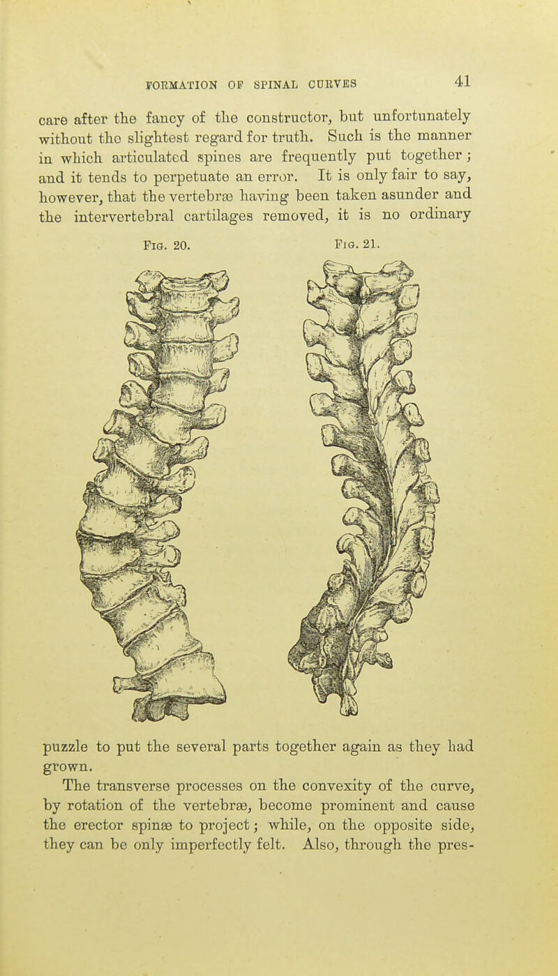 care after the fancy of the constructor, but unfortunately without the slightest regard for truth. Such is the manner in which articulated spines are frequently put together; and it tends to perpetuate an error. It is only fair to say, however, that the vertebras having been taken asunder and the intervertebral cartilages removed, it is no ordinary Pig. 20. Pig. 21. puzzle to put the several parts together again as they had grown. The transverse processes on the convexity of the curve, by rotation of the vertebras, become prominent and cause the erector spinas to project; while, on the opposite side, they can be only imperfectly felt. Also, through the pres-