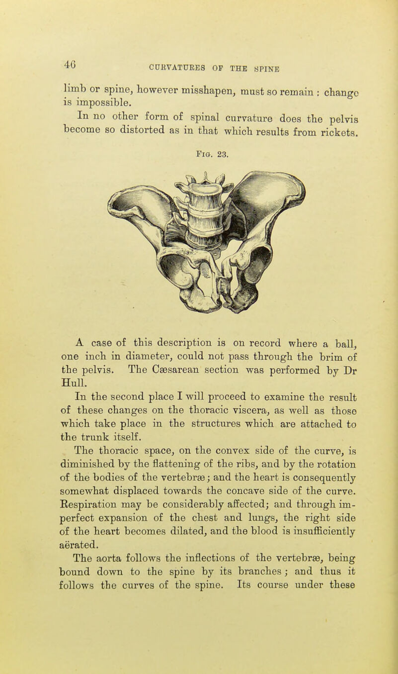 limb or spine, however misshapen, must so remain : change is impossible. In no other form of spinal curvature does the pelvis become so distorted as in that which results from rickets. Pig. 23. A case of this description is on record where a ball, one inch in diameter, could not pass through the brim of the pelvis. The Caesarean section was performed by Dr Hull. In the second place I will proceed to examine the result of these changes on the thoracic viscera, as well as those which take place in the structures which are attached to the trunk itself. The thoracic space, on the convex side of the curve, is diminished by the flattening of the ribs, and by the rotation of the bodies of the vertebras; and the heart is consequently somewhat displaced towards the concave side of the curve. Respiration may be considerably affected; and through im- perfect expansion of the chest and lungs, the right side of the heart becomes dilated, and the blood is insufficiently aerated. The aorta follows the inflections of the vertebrae, being bound down to the spine by its branches ; and thus it follows the curves of the spine. Its course under these