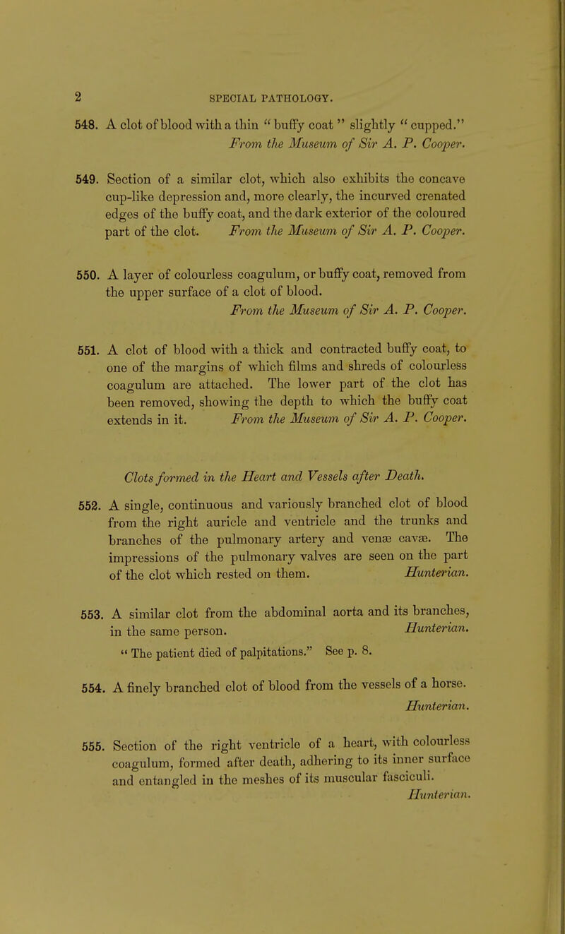 548. A clot of blood with a thin  buffy coat  slightly  cupped. From the Museum of Sir A. P. Coojyer. 549. Section of a similar clot, which also exhibits the concave cup-like depression and, more clearly, the incurved crenated edges of the buffy coat, and the dark exterior of the coloured part of the clot. From the Museum of Sir A. P. Cooper. 550. A layer of colourless coagulum, or buffy coat, removed from the upper surface of a clot of blood. From the Museum of Sir A. P. Cooper. 551. A clot of blood with a thick and contracted buffy coat, to one of the margins of which films and shreds of colourless coagulum are attached. The lower part of the clot has been removed, showing the depth to which the buffy coat extends in it. From the Museum of Sir A. P. Cooper. Clots formed in the Heart and Vessels after Death. 553. A single, continuous and variously branched clot of blood from the right auricle and ventricle and the trunks and branches of the pulmonary artery and venae cavse. The impressions of the pulmonary valves are seen on the part of the clot which rested on them. Hunterian. 553. A similar clot from the abdominal aorta and its branches, in the same person. Hunterian.  The patient died of palpitations. See p. 8. 554. A finely branched clot of blood from the vessels of a horse. Hunterian. 555. Section of the right ventricle of a heart, with colourless coagulum, formed after death, adhering to its inner surface and entangled in the meshes of its muscular fasciculi. Hunterian.