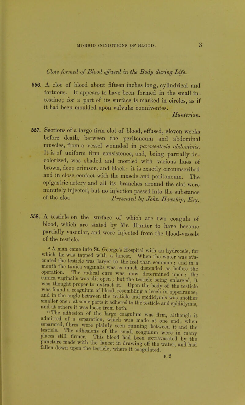 MORBID CONDITIONS 9F BLOOD. Clots formed of Blood effused in the Body during Life. 556. A clot of blood about fifteen inches long, cylindrical and tortuous. It appears to have been formed in the small in- testine ; for a part of its surface is mai'ked in circles, as if it had been moulded upon valvulaa conniventes. Hunterian. 657. Sections of a large firm clot of blood, efi'used, eleven weeks before death, between the peritoneum and abdominal muscles, from a vessel wounded in paracentesis abdominis. It is of uniform firm consistence, and, being partially de- colorized, was shaded and mottled with various hues of brown, deep crimson, and black: it is exactly circumscribed and in close contact with the muscle and peritoneum. The epigastric artery and all its branches around the clot were minutely injected, but no injection passed into the substance of the clot. Presented by John Howship, Esq. 558. A testicle on the surface of which are two coagula of blood, which are stated by Mr. Hunter to have become partially vascular, and were injected from the blood-vessels of the testicle. A man came into St. George's Hospital with an hydrocele, for which he was tapped with a lancet. When the water was eva- cuated the testicle was larger to the feel than common ; and in a month the tunica vagmalis was as much distended as before the operation. The radical cure was now determined upon; the tunica vaginalis was sHt open ; but the testicle being enlarged it was thought proper to extract it. Upon the body of the testicle was found a coagulum of blood, resembHng a leech in appearance- and m the angle between the testicle and epididymis was another smaller one : at some parts it adhered to the testicle and epididymis and at others it was loose from both. ' ''The adhesion of the large coagulum was firm, although it admitted of a separation, which was made at one end- wlien separated, fibres were plainly seen running between it and the testicle. The adhesions of the small coagulum wore in many places still firmer. This blood had been extravasated by the puncture made with the lancet in drawing off the water, and had tailen down upon the testicle, where it coagulated. b2