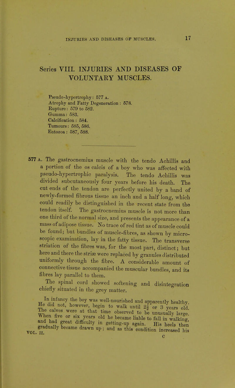 Series VIIL INJURIES AND DISEASES OF VOLUNTAKY MUSCLES. Pseudo-hypertrophy: 577 a. Atrophy and Fatty Degeneration : 678. Eupture: 579 to 582. Gumma: 583. Calcification: 584. Tumours: 585, 586. Eatozoa : 587, 588. 577 a. The gastrocnemius muscle with the tendo Achillis and a portion of the os calcis of a boy who was affected with pseudo-hypertrophic paralysis. The tendo Achillis was divided subcutaneously four years before his death. The cut ends of the tendon are perfectly united by a band of newly-formed fibrous tissue an inch and a half long, which could readily be distinguished in the recent state from the tendon itself. The gastrocnemius muscle is not more than one third of the normal size, and presents the appearance of a mass of adipose tissue. No trace of red tint as of muscle could be found; but bundles of muscle-fibres, as shown by micro- scopic examination, lay in the fatty tissue. The transverse striation of the fibres was, for the most part, distinct; but here and there the stri« were replaced by granules distributed uniformly through the fibre. A considerable amount of connective tissue accompanied the muscular bundles, and its fibres lay parallel to them. The spinal cord showed softening and disintegration chiefly situated in the grey matter. In infancy the boy was well-uourished and apparently healthy He did not, however, begin to walk until 2| or 3 years old calves were at that time observed to be unusually large! When five or six years old he became liable to fall in walking, and had great difficulty in getting-up again. His heels then VOL Ti ^ ^' ^^' '^ hi«