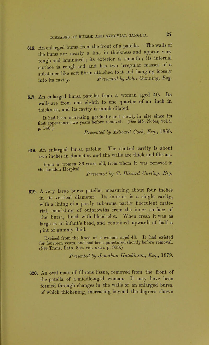 616. An enlarged bursa from the front of a patella. The walls of the bursa are nearly a line in thickness and appear very tough and laminated ; its exterior is smooth ; its internal surface is rough and and has two irregular masses of a substance Hke soft fibrin attached to it and hanging loosely into its cavity. Presented by John Gunning, Esq. 617. An enlarged bursa patellse from a woman aged 40. Its walls are from one eighth to one quarter of an inch in thickness, and its cavity is much dilated. It had been increasing gradually and slowly in size since its first appearance two years before removal. (See MS. Notes, vol. i. ^ ^ Presented hy Edward Cock, Esq., 1868. 618. An enlarged bursa patellse. The central cavity is about two inches in diameter, and the walls are thick and fibrous. From a woman, 36 years old, from whom it was removed in the London Hospital. ^7- Presented hy T. Blizard Curliny, Esq. 619. A very large bursa patellse, measuring about four inches in its vertical diameter. Its interior is a single cavity, with a lining of a partly tuberous, partly flocculent mate- rial, consisting of outgrowths from the inner surface of the bursa, lined with blood-clot. When fresh it was as large as an infant's head, and contained upwards of half a pint of gummy fluid. Excised from the knee of a woman aged 48. It had existed for fourteen years, and had been punctured shortly before removal. (See Trans. Path. Soc. vol. xxxi. p. 383.) Presented by Jonathan Hutchinson, Esq., 1879. 620. An oval mass of fibrous tissue, removed from the front of the patella of a middle-aged woman. It may have been formed through changes in the walls of an enlarged bursa, of which thickening, increasing beyond the degrees shown