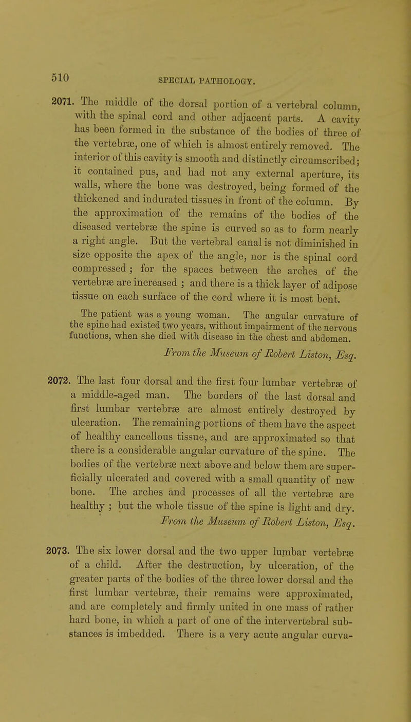 2071. The middle of the dorsal portion of a vertebral column, with the spinal cord and other adjacent parts. A cavity has been formed in the substance of the bodies of thi-ee of the vertebrae, one of which is almost entirely removed. The interior of this cavity is smooth and distinctly circumscribed; it contained pus, and had not any external aperture, its M'alls, where the bone was destroyed, being formed of the thickened and indurated tissues in front of the column. By the approximation of the remains of the bodies of the diseased vertebrae the spine is curved so as to form nearly a right angle. But the vertebral canal is not diminished in size opposite the apex of the angle, nor is the spinal cord compressed ; for the spaces between the arches of the vertebrae are increased ; and there is a thick layer of adipose tissue on each surface of the cord where it is most bent. The patient was a young woman. The angular curvature of the spine had existed two years, without impairment of the nervous functions, when she died with disease in the chest and abdomen. 'om the Museum of Robert Liston, Esq. 2072. The last four dorsal and the first four lumbar vertebrae of a middle-aged man. The borders of the last dorsal and first lumbar vertebrae are almost entirely destroyed by ulceration. The remaining portions of them have the aspect of healthy cancellous tissue, and are approximated so that there is a considerable angular curvature of the spine. The bodies of the vertebrae next above and below them are super- ficially ulcerated and covered with a small quantity of new bone. The arches and processes of all the vertebrtB are healthy ; but the whole tissue of the spine is light and dry. Fo'om the Museum of Robert Liston, Esq. 2073. The six lower dorsal and the two upper lumbar vertebra of a child. After the destruction, by ulceration, of the greater parts of the bodies of the three lower dorsal and the first lumbar vertebrae, their remains were approximated, and are completely and firmly united in one mass of rather hard bone, in which a part of one of the intervertebral sub- stances is imbedded. There is a very acute angular curva-