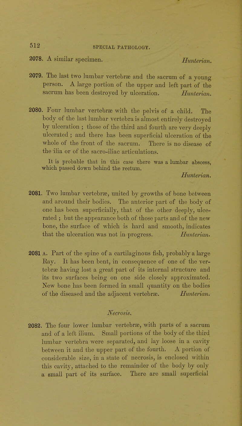 2078. A similar specimen. Hunterian. 2079. The last two lumbar vertebrae and the sacrum of a young person. A large portion of the upper and left part of the sacrum has been destroyed by ulceration. Hunterian. 2080. Four lumbar vertebrae with the pelvis of a child. The body of the last lumbar vertebra is almost entii-ely destroyed by ulceration ; those of the third and fourth are very deeply ulcerated ; and there has been superficial ulceration of the whole of the front of the sacrum. There is no disease of the ilia or of the sacro-iliac articulations. It is probable that in this case there was a lumbar abscess, which passed down behind the rectum. Hunterian. 2081. Two lumbar vertebrae, united by growths of bone between and around their bodies. The anterior part of the body of one has been superficially, that of the other deeply, ulce- rated ; but the appearance both of those parts and of the new bone, the surface of which is hard and smooth, indicates that the ulceration was not in progress. Hunterian. 2081 A. Part of the spine of a cartilaginous fish, probably a large Ray. It has been bent, in consequence of one of the ver- tebrae having lost a great part of its internal structure and its two surfaces being on one side closely approximated. New bone has been formed in small quantity on the bodies of the diseased and the adjacent vertebrae. Hunterian. Necrosis. 2082. The four lower lumbar vertebrae, with parts of a sacrum and of a left ilium. Small portions of the body of the third lumbar vertebra were separated, and lay loose in a cavity between it and the upper part of the fourth. A portion of considerable size, in a state of necrosis, is enclosed within this cavity, attached to the remainder of the body by only a small part of its surface. There are small superficial