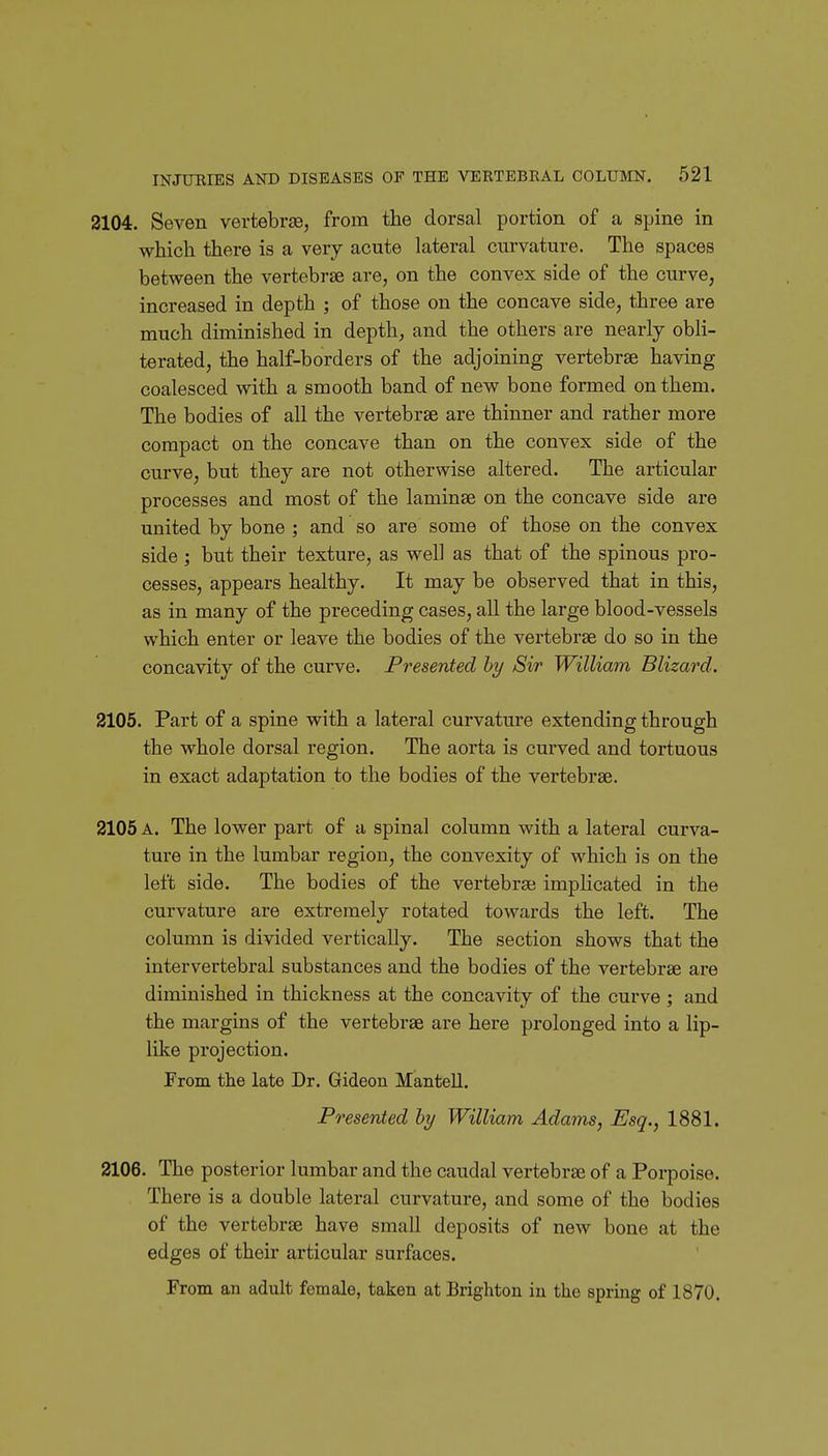 2104. Seven vertebras, from the dorsal portion of a spine in which there is a very acute lateral curvature. The spaces between the vertebrae are, on the convex side of the curve, increased in depth ; of those on the concave side, three are much diminished in depth, and the others are nearly obli- terated, the half-borders of the adjoining vertebrae having coalesced with a smooth band of new bone formed on them. The bodies of all the vertebrae are thinner and rather more compact on the concave than on the convex side of the curve, but they are not otherwise altered. The articular processes and most of the laminae on the concave side are united by bone ; and so are some of those on the convex side ; but their texture, as well as that of the spinous pro- cesses, appears healthy. It may be observed that in this, as in many of the preceding cases, all the large blood-vessels which enter or leave the bodies of the vertebrae do so in the concavity of the curve. Presented by Sir William Blizard. 2105. Part of a spine with a lateral curvature extending through the whole dorsal region. The aorta is curved and tortuous in exact adaptation to the bodies of the vertebrae. 2105 A. The lower part of a spinal column with a lateral curva- ture in the lumbar region, the convexity of which is on the left side. The bodies of the vertebra; implicated in the curvature are extremely rotated towards the left. The column is divided vertically. The section shows that the intervertebral substances and the bodies of the vertebrae are diminished in thickness at the concavity of the curve ; and the margins of the vertebrae are here prolonged into a lip- like projection. From the late Dr. Gideon Mantell. Presented hy William Adams, Esq., 1881. 2106. The posterior lumbar and the caudal vertebrae of a Porpoise. There is a double lateral curvature, and some of the bodies of the vertebrae have small deposits of new bone at the edges of their articular surfaces. From an adult female, taken at Brighton in the spring of 1870.