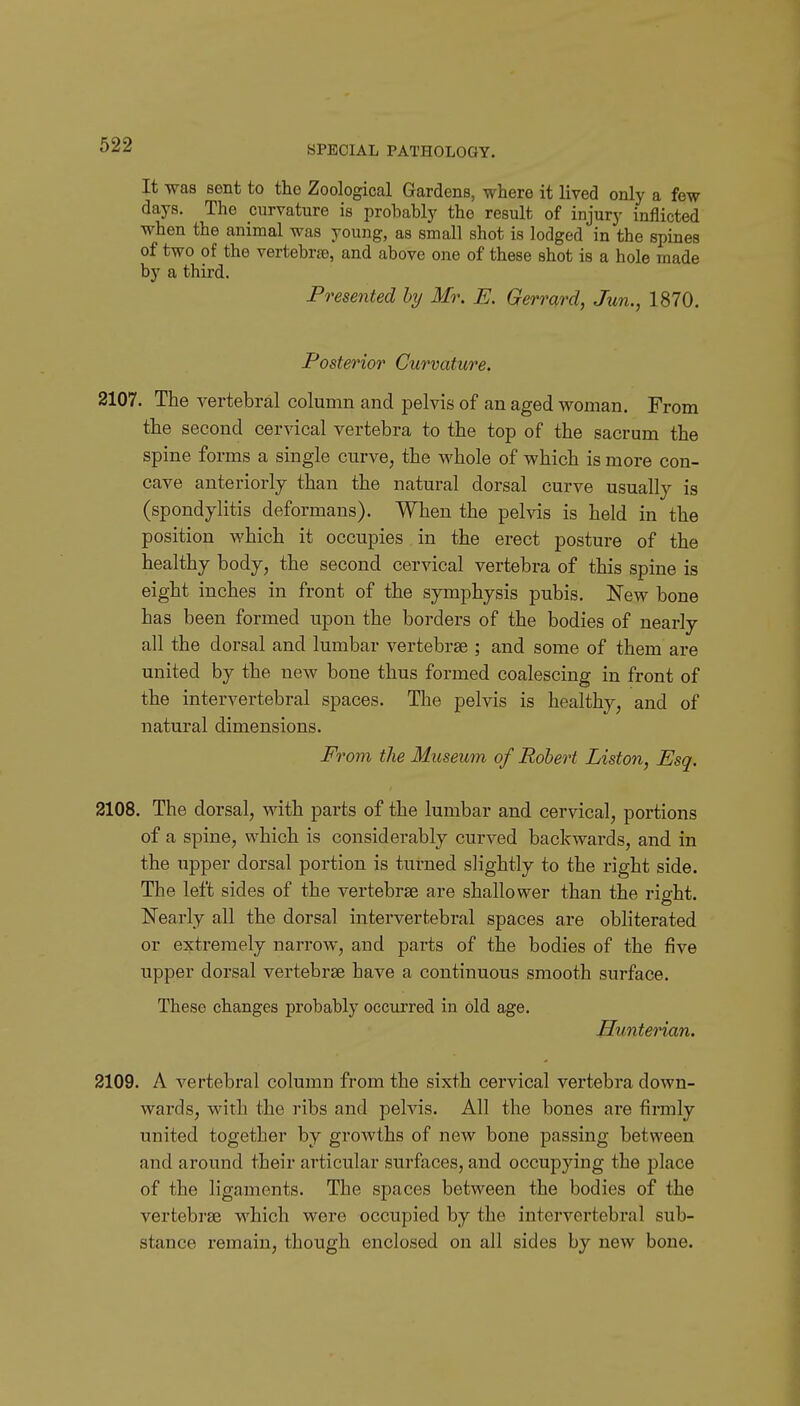 It -was sent to the Zoological Gardens, where it lived only a few days. The curvature is probably the result of injury inflicted when the animal was young, as small shot is lodged in the spines of two of the vertebrse, and above one of these shot is a hole made by a third. Presented hy Mr. E. Gerrard, Jun., 1870. Posterior Curvature. 2107. The vertebral column and pelvis of an aged woman. From the second cervical vertebra to the top of the sacrum the spine forms a single curve, the whole of which is more con- cave anteriorly than the natural dorsal curve usually is (spondylitis deformans). When the pelvis is held in the position which it occupies in the erect posture of the healthy body, the second cervical vertebra of this spine is eight inches in front of the symphysis pubis. New bone has been formed upon the borders of the bodies of nearly all the dorsal and lumbar vertebrae ; and some of them are united by the new bone thus formed coalescing in front of the intervertebral spaces. The pelvis is healthy, and of natural dimensions. From the Museum of Robert Liston, Esq. 2108. The dorsal, with parts of the lumbar and cervical, portions of a spine, which is considerably curved backwards, and in the upper dorsal portion is turned slightly to the right side. The left sides of the vertebrae are shallower than the right. Nearly all the dorsal intervertebral spaces are obliterated or extremely narrow, and parts of the bodies of the five upper dorsal vertebrae have a continuous smooth surface. These changes probably occurred in old age. Hunterian. 2109. A vertebi-al column from the sixth cervical vertebra down- wards, with the ribs and pelvis. All the bones are firmly united together by growths of new bone passing between and around their articular surfaces, and occupying the place of the ligaments. The spaces between the bodies of the vertebrae which were occupied by the intervertebral sub- stance remain, though enclosed on all sides by new bone.