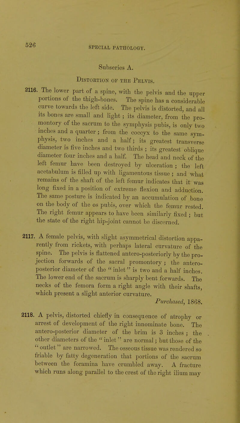 SPECIAL PATHOLOGY. Subseries A. DiSTOETION OF THE PelVIS. 2116. The lower part of a spine, with the pelvis and the upper portions of the thigh-bones. The spine has a considerable curve towards the left side. The pelvis is distorted, and all its bones are small and hght ; its diameter, from the pro- montory of the sacrum to the symphysis pubis, is only two inches and a quarter; from the coccyx to the same sym- physis, two inches and a half; its greatest transverse diameter is five inches and two thirds ; its greatest oblique diameter four inches and a half. The head and neck of the left femur have been destroyed by ulceration ; the left acetabulum is filled up with ligamentous tissue ; and what remains of the shaft of the left femur indicates that it was long fixed in a position of extreme flexion and adduction. The same posture is indicated by an accumulation of bone on the body of the os pubis, over which the femur rested. The right femur appears to have been similarly fixed ; but the state of the right hip-joint cannot be discerned. 2117. A female pelvis, with slight asymmetrical distortion appa- rently from rickets, with perhaps lateral curvature of the spine. The pelvis is flattened antero-posteriorly by the pro- jection forwards of the sacral promontory ; the antero- posterior diameter of the inlet' is two and a half inches. The lower end of the sacrum is sharply bent forwards. The necks of the femora form a right angle with their shafts, which present a slight anterior curvature. Purchased, 1868. 2118. A pelvis, distorted chiefly in consequence of atrophy or arrest of development of the right innominate bone. The antero-posterior diameter of the brim is 3 inches ; the other diameters of the  inlet are normal; but those of the  outlet are narrowed. The osseous tissue was rendered so friable by fatty degeneration that portions of the sacrum between the foramina have crumbled away. A fractuz-e which runs along parallel to the crest of the right ilium may