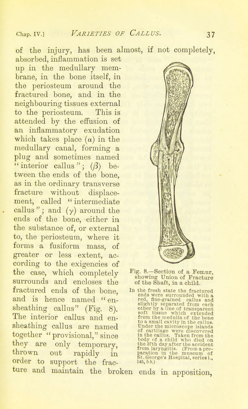 of the injury, has been almost, if not completely, absorbed, inflammation is set up in the medullary mem- brane, in the bone itself, in the periosteum around the fractured bone, and in the neighbouring tissues external to the periosteum. This is attended by the effusion of an inflammatory exudation which takes place (a) in the medullary canal, forming a plug and sometimes named interior callus; (/3) be- tween the ends of the bone, as in the ordinary transverse fracture without displace- ment, called  intermediate callus ; and (y) around the ends of the bone, either in the substance of, or external to, the periosteum, where it forms a fusiform mass, of greater or less extent, ac- cording to the exigencies of the case, which completely surrounds and encloses the fractured ends of the bone, and is hence named  en- sheatbing callus (Fig. 8). The interior callus and en- sheathing callus are named together  provisional, since only temporary, out rapidly in support the frac- maintain the broken they are thrown order to ture and Fig. 8.—Section of a Femur, showing Union of Fracture of the Shaft, in a child. In the fresh state the fractured ends were surrounded with a red, fine-grained callus and slightly separated from each other by a line of transparent soft tissue which extended from the medulla of the hone to a small cavity in the callus. Under the microscope islands of cartilage were discovered in the callus. Taken from the body of a child who died on the 37th day after the accident from laryngitis. (From a pre- paration in the museum of St. George's Hospital, series i., 145,6 6.) ends in apposition,