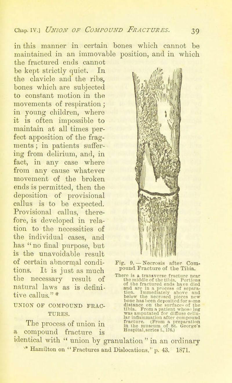 chap, iv.] Union of Compound Fractures. in this manner in certain bones which cannot be maintained in an immovable position, and in which the fractured ends cannot be kept strictly quiet. In the clavicle and the ribs, bones which are subjected to constant motion in the movements of respiration; in young children, where it is often impossible to maintain at all times per- fect apposition of the frag- ments ; in patients suffer- ing from delirium, and, in fact, in any case where from any cause whatever movement of the broken ends is permitted, then the deposition of jnovisional callus is to be expected. Provisional callus, there- fore, is developed in rela- tion to the necessities of the individual cases, and has no final purpose, but is the unavoidable result of certain abnormal condi- tions. It is just as much the necessary result of natural laws as is defini- tive callus. * UNION OF COMPOUND FRAC- TURES. The process of union in a compound fracture is identical with  union by granulation in an ordinary x* Hamilton on Fractures and Dislocations, p. 43. 1871. Fig. 9. — Necrosis after Com- pound Fracture of the Tibia. There is a trantverse fracture near the middle of the tibia. Portions of tbe fractured ends have died and are in a process of separa- tion. Immediately above and below the necrosed pieces new bone has been deposited for some distance on the surfaces of the tibia. From a patient whose leg was amputated for diffuse cellu- lar inflammation after compound fracture. (From a preparation in the museum of St. George's Hosrital,series i., 176.)
