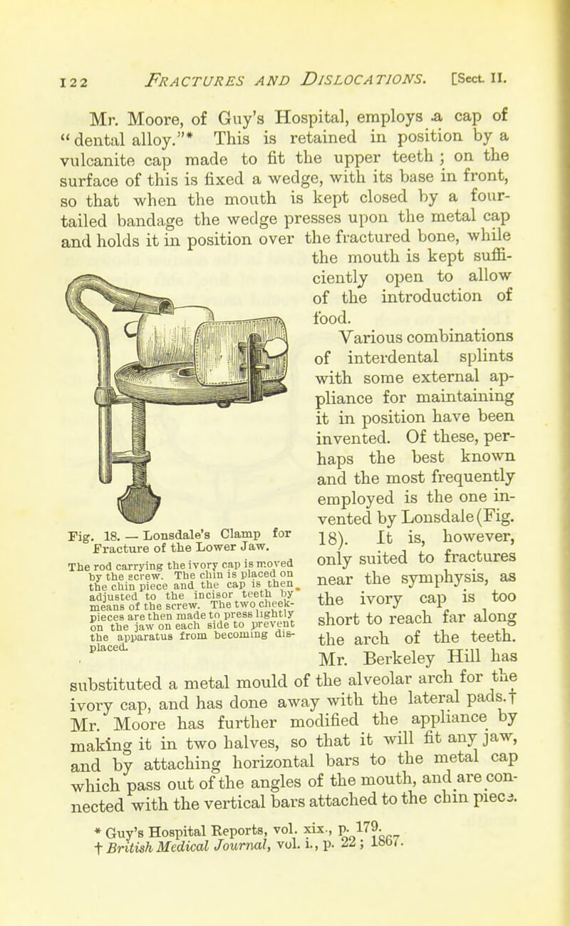 Mr. Moore, of Guy's Hospital, employs .a cap of  dental alloy.* This is retained in position by a vulcanite cap made to fit the upper teeth ; on the surface of this is fixed a wedge, with its base in front, so that when the mouth is kept closed by a four- tailed bandage the wedge presses upon the metal cap and holds it in position over the fractured bone, while the mouth is kept suffi- ciently open to allow of the introduction of food. Various combinations of interdental splints with some external ap- pliance for maintaining it in position have been invented. Of these, per- haps the best known and the most frequently employed is the one in- vented by Lonsdale (Fig. 18). It is, however, only suited to fractures near the symphysis, as the ivory cap is too short to reach far along the arch of the teeth. Mr. Berkeley Hill has substituted a metal mould of the alveolar arch for the ivory cap, and has done away with the lateral pads.t Mr. Moore has further modified the appliance by making it in two halves, so that it will fit any jaw, and by attaching horizontal bars to the metal cap which pass out of the angles of the mouth, and are con- nected with the vertical bars attached to the chin piecj. * Guy's Hospital Reports, vol. xix., P- 179. t British Medical Journal, vol. l, p. &l; loo'- Fig. 18. — Lonsdale's Clamp for Fracture of the Lower Jaw. The rod carrying the ivory cap is moved by the screw. Tbe chin is placed on the chin piece and the cap is then adjusted to the incisor teeth by means of the screw. The two cheek- pieces are then made to press ligbtly on the jaw on each side to prevent the apparatus from becoming dis- placed.