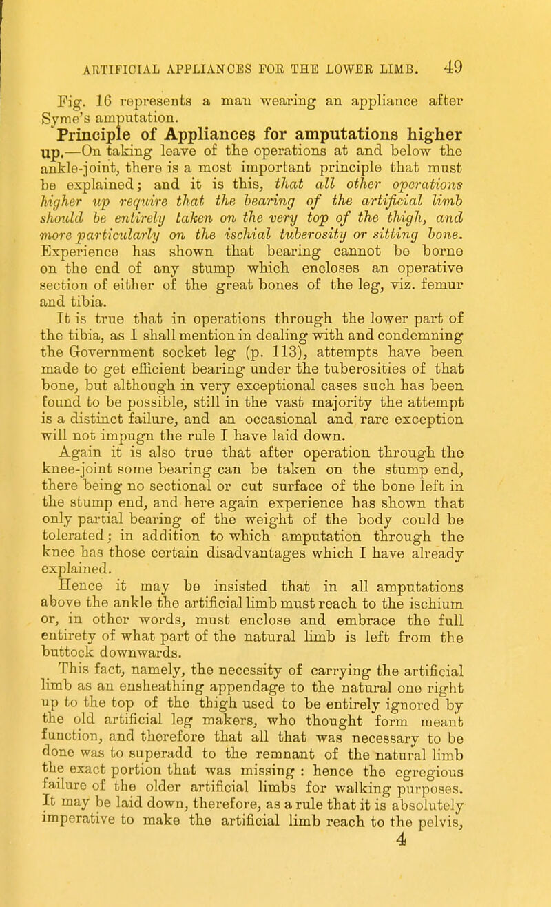 Fig. 16 repi'esents a mau wearing an appliance after Syme's amputation. Principle of Appliances for amputations higher up.—On taking leave of the operations at and below the ankle-joint^ there is a most important principle that must he explained; and it is this^ that all other operations higher zip require that the bearing of the artificial limb should he entirely taken on the very top of the thigh, and more particularly on the ischial tuberosity or sitting bone. Experience has shown that bearing cannot be borne on the end of any stump which encloses an operative section of either of the great bones of the leg, viz. femur and tibia. It is true that in operations through the lower part of the tibia, as I shall mention in dealing with and condemning the Government socket leg (p. 113), attempts have been made to get eJOElcient bearing under the tuberosities of that bone, but although in very exceptional cases such has been found to be possible, still in the vast majority the attempt is a distinct failure, and an occasional and rare exception will not impugn the rule I have laid down. Again it is also true that after operation through the knee-joint some bearing can be taken on the stump end, there being no sectional or cut surface of the bone left in the stump end, and here again experience has shown that only partial bearing of the weight of the body could be tolerated; in addition to which amputation through the knee has those certain disadvantages which I have already explained. Hence it may be insisted that in all amputations above the ankle the artificial limb must reach to the ischium or, in other words, must enclose and embrace the full entirety of what part of the natural limb is left from the buttock downwards. This fact, namely, the necessity of carrying the artificial limb as an ensheathing appendage to the natural one riglit up to the top of the thigh used to be entirely ignored by the old artificial leg makers, who thought form meant function, and therefore that all that was necessary to be done was to superadd to the remnant of the natural limb the exact portion that was missing : hence the egregious failure of the older artificial limbs for walking purposes. It may be laid down, therefore, as a rule that it is absolutely imperative to make the artificial limb reach to the pelvis, 4