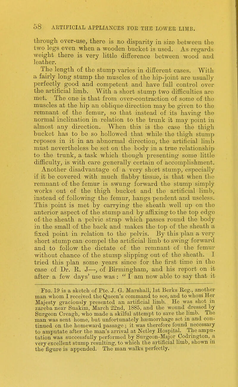tlarongh over-use, there is no disparity in size between tlie two legs even when a wooden bucket is used. As regards weight there is very little difference between wood and leather. The length of the stump varies in different cases. With a fairly long stump the muscles of the hip-joint are usually perfectly good and competent and have full control over the artificial limb. With a short stump two difficulties are met. The one is that from over-contraction of some of the muscles at the hip an oblique direction may be given to the remnant of the femur, so that instead of its having the normal inclination in relation to the trunk it may point in almost any direction. When this is the case the thigh bucket has to be so hollowed that while the thigh stu^mp reposes in it in an abnormal direction, the artificial limb must nevertheless be set on the body in a true relationship to the trunk, a task which though presenting some little difficulty, is with care generally certain of accomplishment. Another disadvantage of a very short stump, especially if it be covered with much flabby tissue, is that when the remnant of the femur is swung forward the stump simply works out of the thigh bucket and the artificial limb, instead of following the femur, hangs pendent and useless. This point is met by carrying the sheath well up on the anterior aspect of the stump and by affixing to the top edge of the sheath a pelvic strap which passes round the body in the small of the back and makes the top of the sheath a fixed point in relation to the pelvis. By this plan a very short stump can compel the artificial hmb to swing forward and to follow the dictate of the remnant of the femur without chance of the stump slipping out of the sheath. I tried this plan some years since for the first time in the case of Dr. R. J—, of Birmingham, and his report on it after a few days' use was :  I am now able to say that it Pig. 19 is a sketch of Pte. J. G. Marshall, 1st Berks Reg., another man whom I received the Queen's command to see, and to whom Her Majesty graciously presented an artificial limb. He was shot in zareba near Suakim, March 22nd, 1885, and the wound dressed by Surgeon Creagh, who made a skilful attempt to save the limb. The man was sent home, but unfortunately haamorrhage set in and con- tinued on the homeward passage ; it was therefore found necessary to amputate after the man's arrival at Netley Hospital. The ampu- tation was successfully performed by Surgeon-Major Codrirgton,_a very excellent stump resulting, to which the artificial limb, shown in the figure is appended. The man walks perfectly.