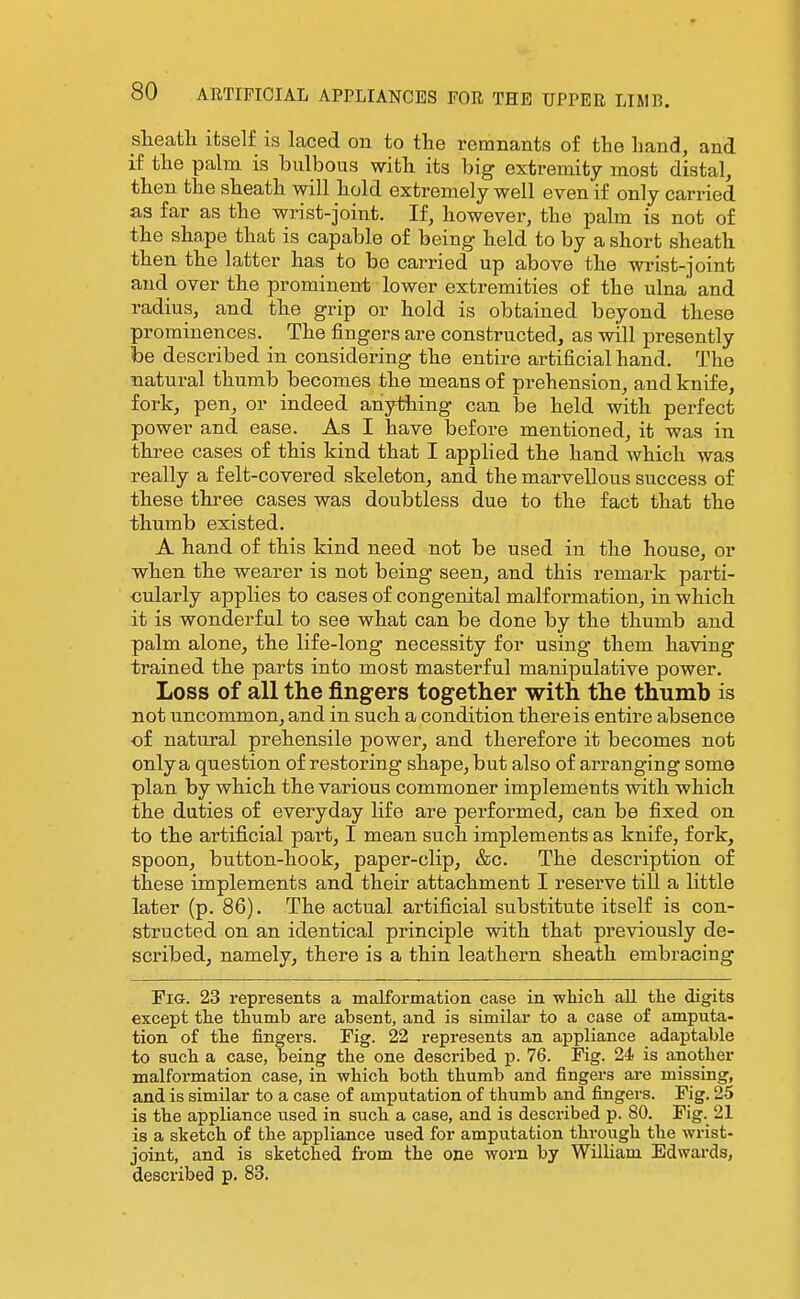 sheath itself is laced on to the remnants of the hand, and if the palm is bulbous with its big extremity most distal, then the sheath will hold extremely well even if only carried as far as the wrist-joint. If, however, the palm is not of the shape that is capable of being- held to by a short sheath then the latter has to be carried up above the wrist-joint and over the prominent lower extremities of the ulna' and radius, and the grip or hold is obtained beyond these prominences. The fingers are constructed, as will presently be described in considering the entire artificial hand. The natural thumb becomes the means of prehension, and knife, fork, pen, or indeed anything can be held with perfect power and ease. As I have before mentioned, it was in three cases of this kind that I applied the hand which was really a felt-covered skeleton, and the marvellous success of these three cases was doubtless due to the fact that the thumb existed. A hand of this kind need not be used in the house, or when the wearer is not being seen, and this remark parti- cularly applies to cases of congenital malformation, in which it is wonderful to see what can be done by the thumb and palm alone, the life-long necessity for using them having trained the parts into most masterful manipulative power. Loss of all the fingers together with the thumb is not uncommon, and in such a condition there is entire absence of natural prehensile power, and therefore it becomes not only a question of restoring shape, but also of arranging some plan by which the various commoner implements with which the duties of everyday life are performed, can be fixed on to the artificial part, I mean such implements as knife, fork, spoon, button-hook, paper-clip, &c. The description of these implements and their attachment I reserve till a little later (p. 86). The actual artificial substitute itself is con- structed on an identical principle with that previously de- scribed, namely, there is a thin leathern sheath embracing Fig. 23 represents a malformation case in whicli all the digits except the thumb are absent, and is similar to a case of amputa- tion of the fingers. Fig. 22 represents an appliance adaptable to such a case, being the one described p. 76. Fig. 24- is another malformation case, in which both thumb and fingers are missing, and is similar to a case of amputation of thumb and fingers. Fig. 25 is the appliance used in such a case, and is described p. 80. Fig. 21 is a sketch of the appliance used for amputation through the wrist- joint, and is sketched from the one worn by William Edwards, described p. 83.