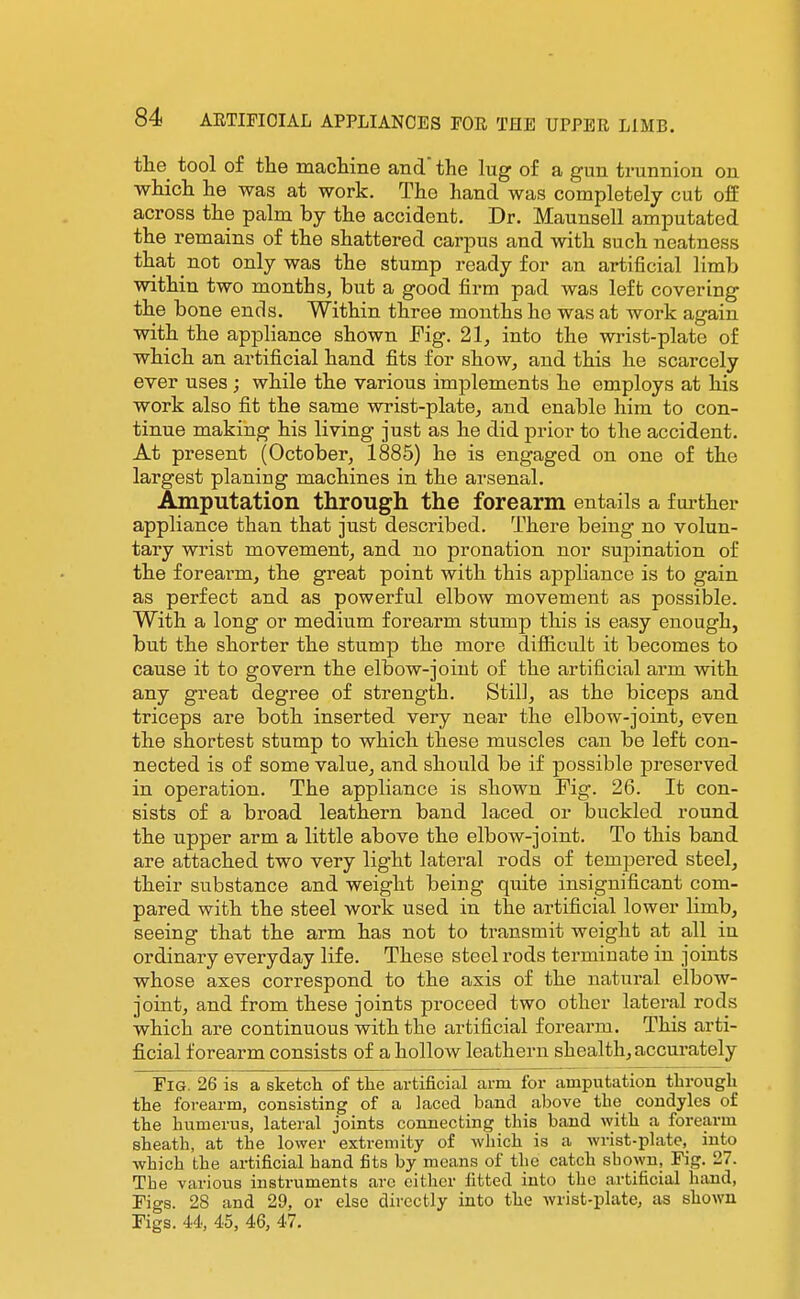 the tool of the macliine and the lug of a gun trunnion on which he was at work. The hand was completely cut off across the palm by the accident. Dr. Maunsell amputated the remains of the shattered carpus and with such neatness that not only was the stump ready for an artificial limb within two months, but a good firm pad was left covering the bone ends. Within three months ho was at work again with the appliance shown Fig. 21, into the wrist-plate of which an artificial hand fits for show, and this he scarcely ever uses; while the various implements he employs at his work also fit the same wrist-plate, and enable him to con- tinue making his living just as he did prior to the accident. At present (October, 1885) he is engaged on one of the largest planing machines in the arsenal. Amputation through the forearm entails a further appliance than that just described. There being no volun- tary wrist movement, and no pronation nor supination of the forearm, the great point with this appliance is to gain as perfect and as powerful elbow movement as possible. With a long or medium forearm stump this is easy enough, but the shorter the stump the more difficult it becomes to cause it to govern the elbow-joint of the artificial arm with any great degi'ee of strength. Still, as the biceps and triceps are both inserted very near the elbow-joint, even the shortest stump to which these muscles can be left con- nected is of some value, and should be if possible preserved in operation. The appliance is shown Pig. 26. It con- sists of a broad leathern band laced or buckled round the upper arm a little above the elbow-joint. To this band are attached two very light lateral rods of tempered steel, their substance and weight being quite insignificant com- pared with the steel work used in the artificial lower limb, seeing that the arm has not to transmit weight at all in ordinary everyday life. These steel rods terminate in joints whose axes correspond to the axis of the natural elbow- joint, and from these joints proceed two other lateral rods which are continuous with the artificial forearm. This arti- ficial forearm consists of a hollow leathern shealth, accurately Fig. 26 is a sketch of the artificial arm for amputation through the forearm, consisting of a laced band above the condyles of the humerus, lateral joints connecting this band with a forearm sheath, at the lower extremity of which is a wrist-plate, into ■which the artificial hand fits by means of the catch shown. Fig. 27. The various instruments are cither fitted into the artificial hand, Figs. 28 and 29, or else directly into the wrist-plate, as shown Figs. U, 45, 46, 47.